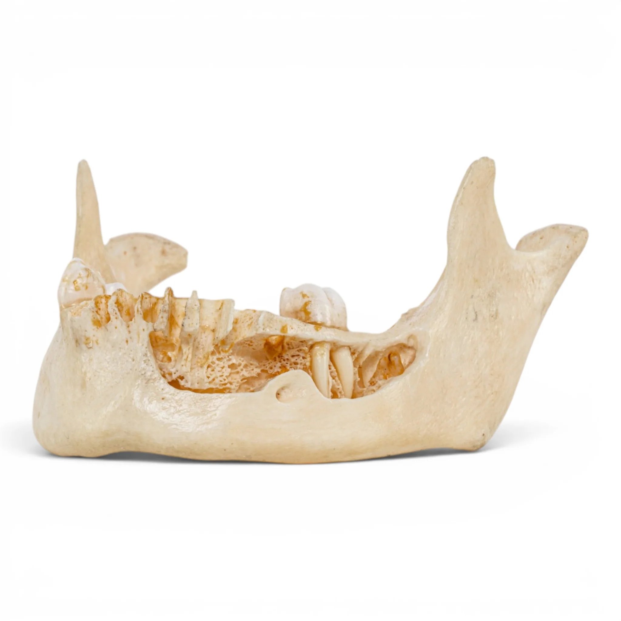 Real Human Mandible - Dissected