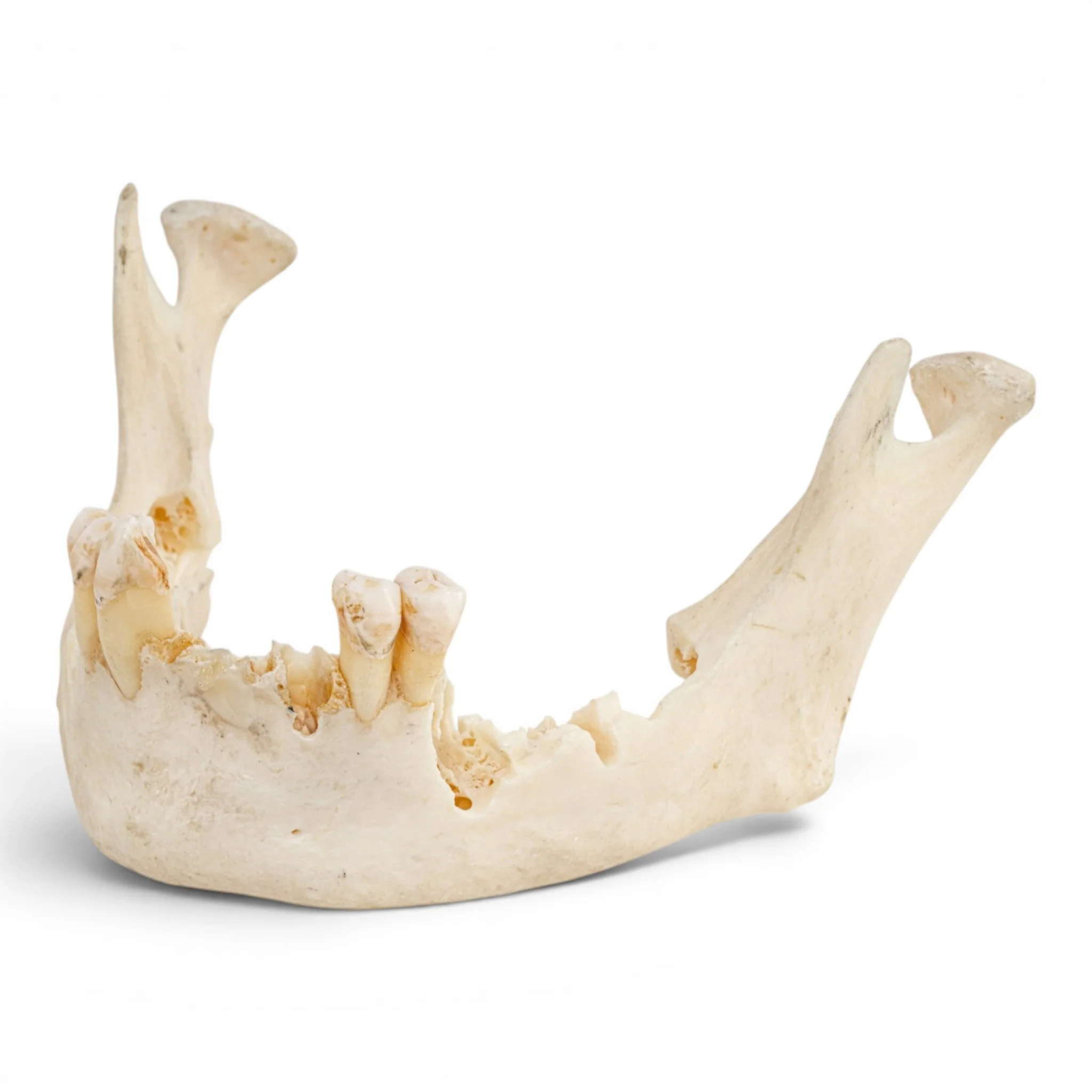 Real Human Mandible - Impaired