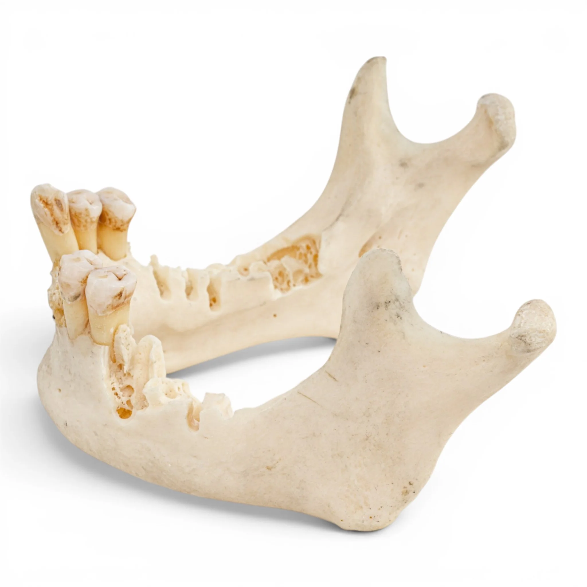 Real Human Mandible - Impaired - Image 4