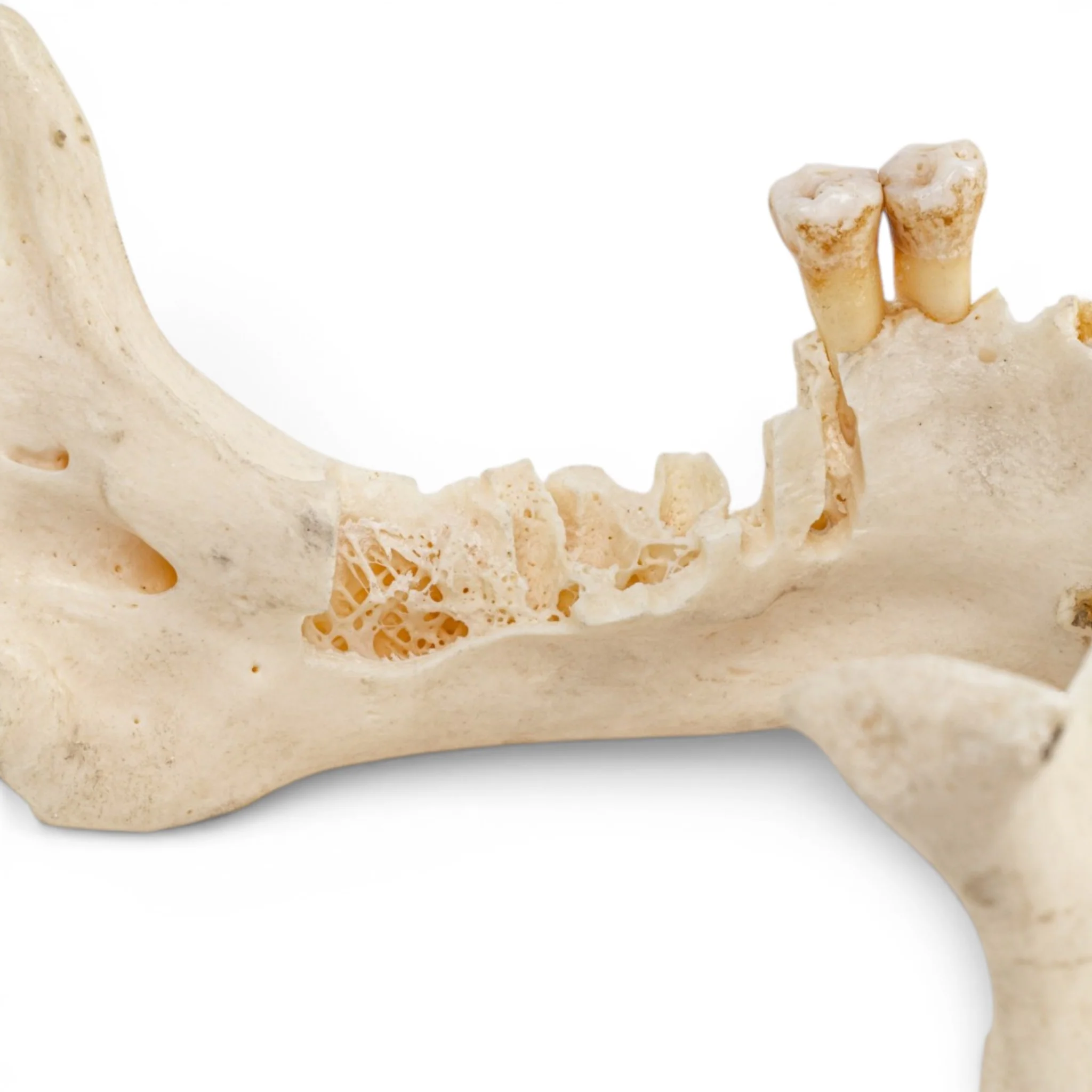 Real Human Mandible - Impaired - Image 6