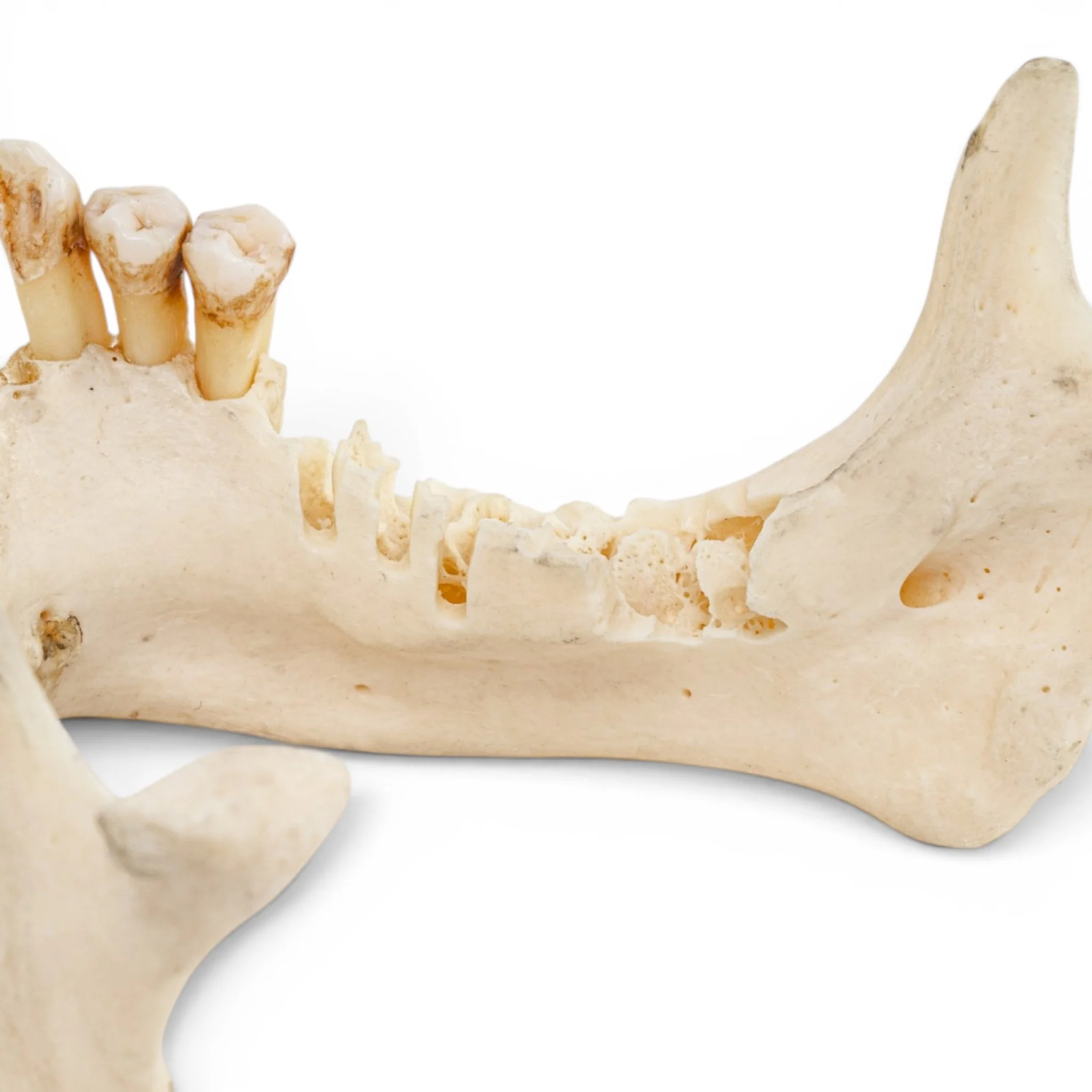 Real Human Mandible - Impaired - Image 7
