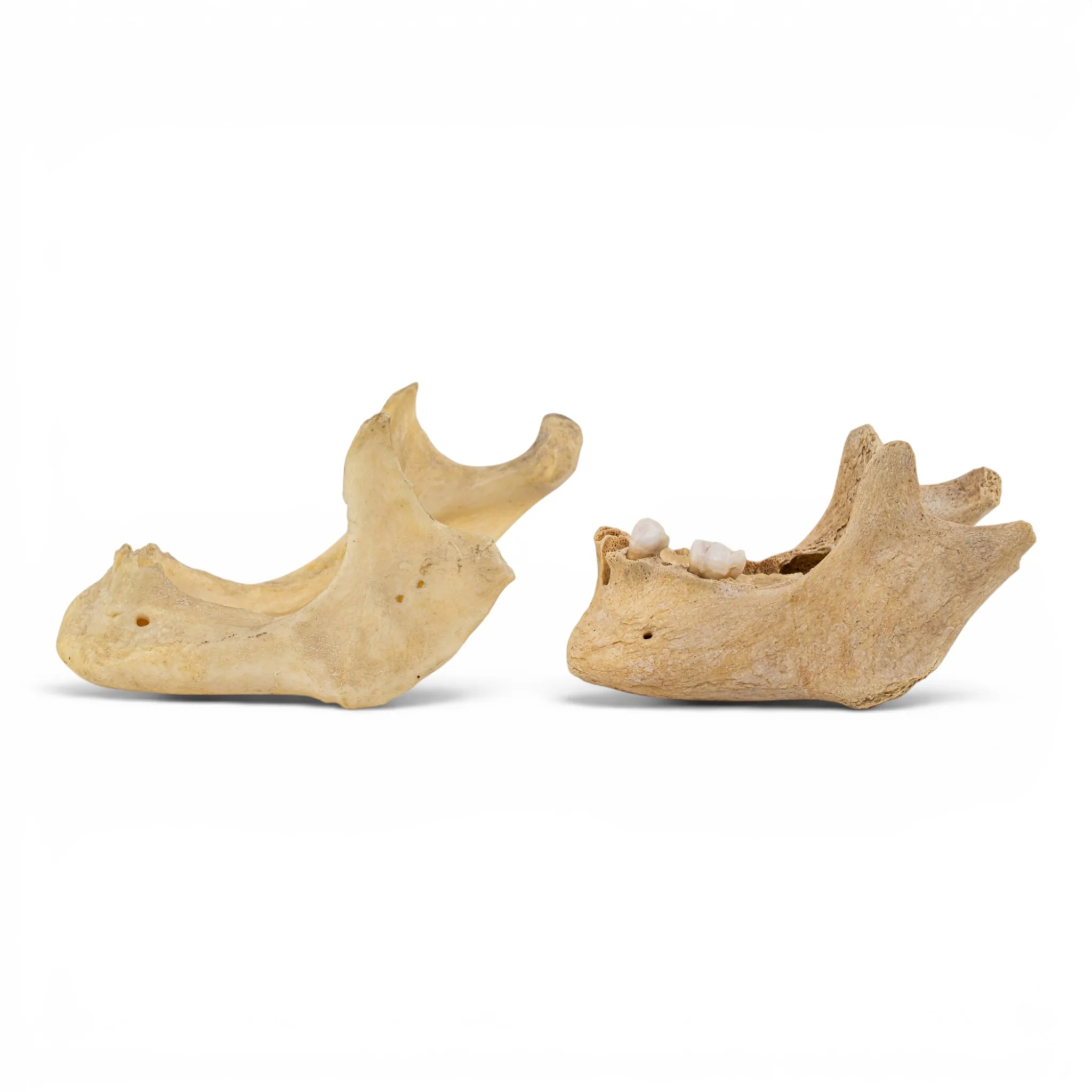 Real Human Mandible - Pathology - Set of 2 - Image 4