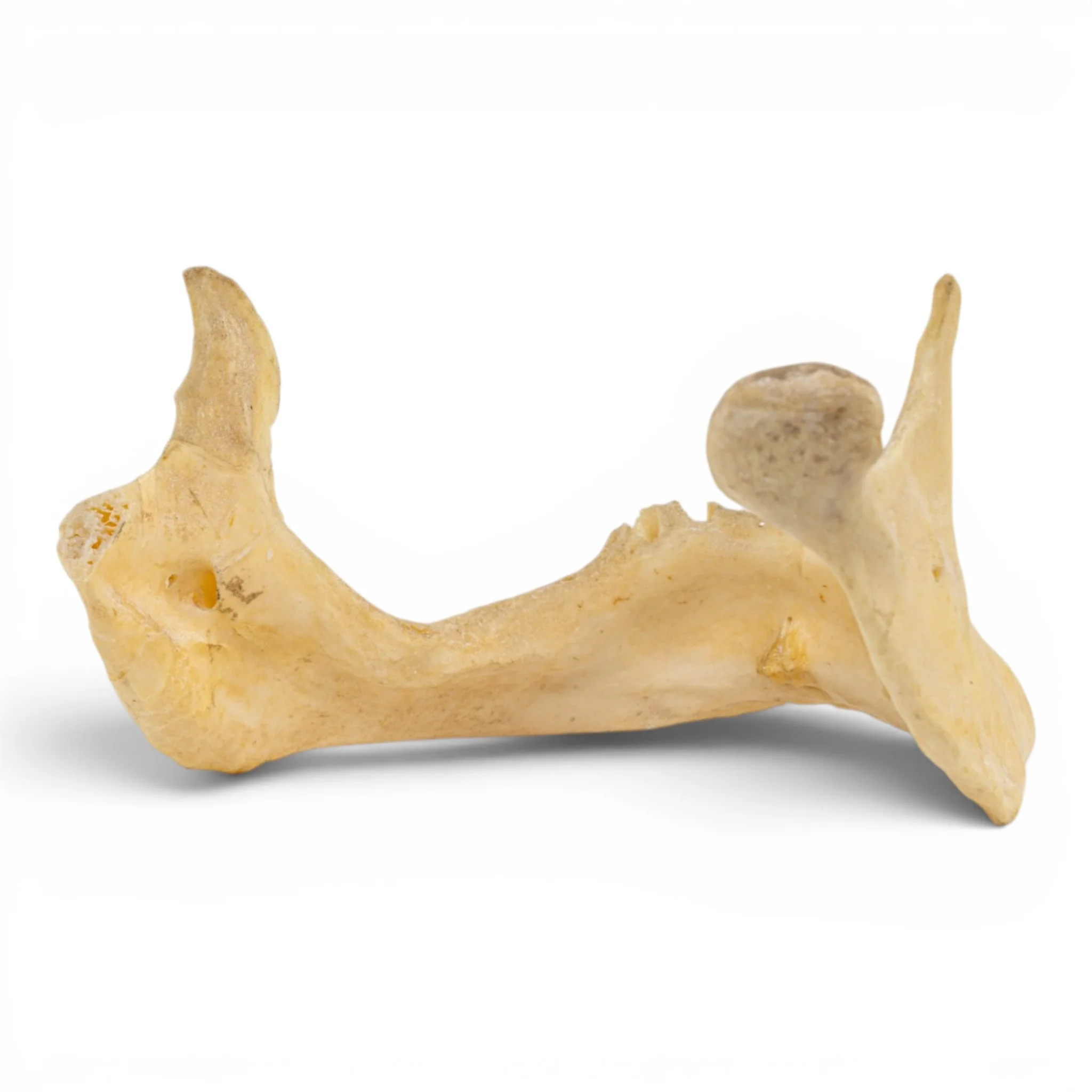 Real Human Mandible - Pathology - Set of 2 - Image 7