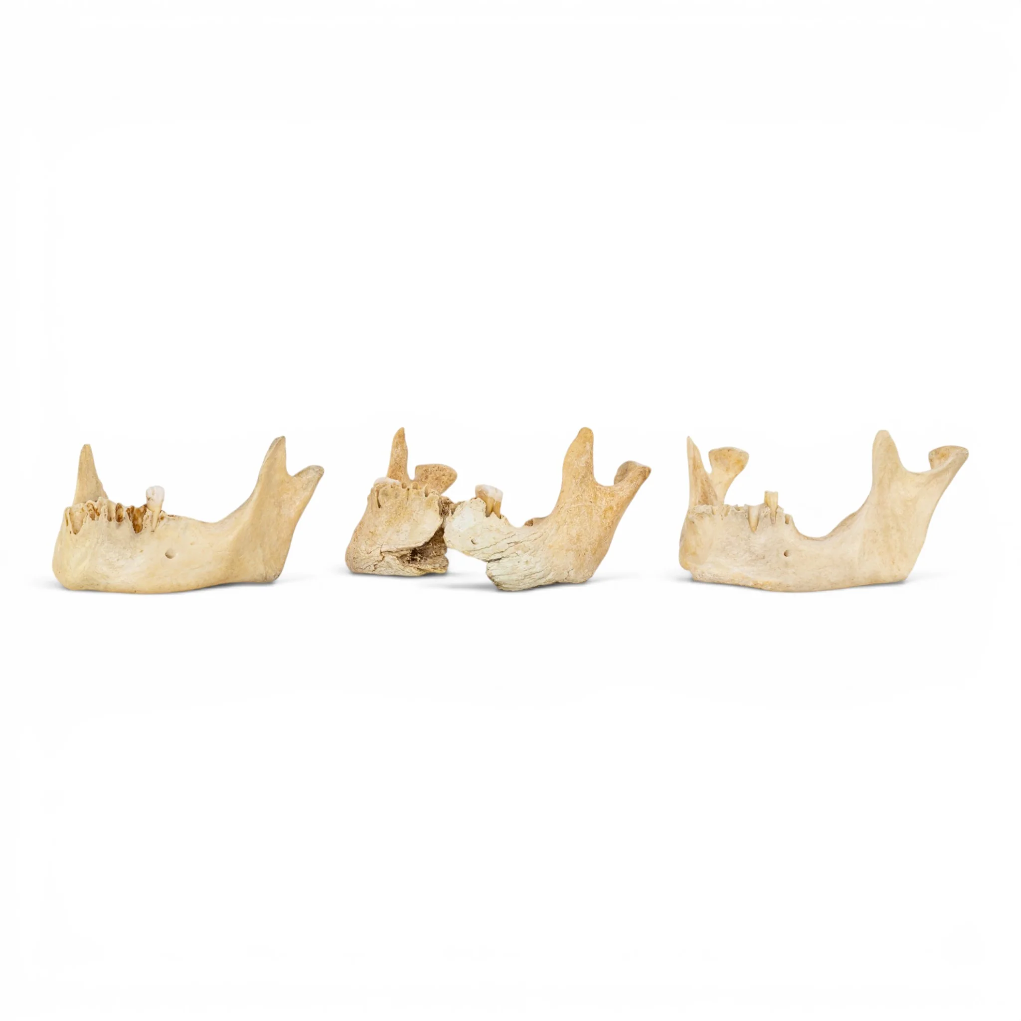 Real Human Mandible - Pathology - Set Of 3
