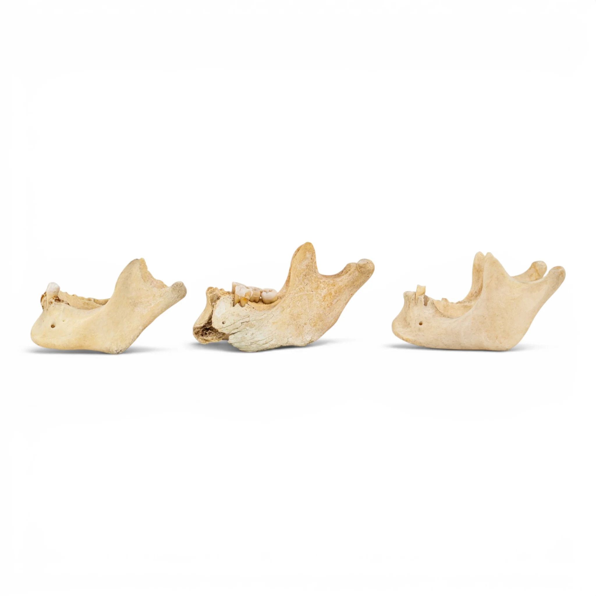 Real Human Mandible - Pathology - Set Of 3 - Image 4