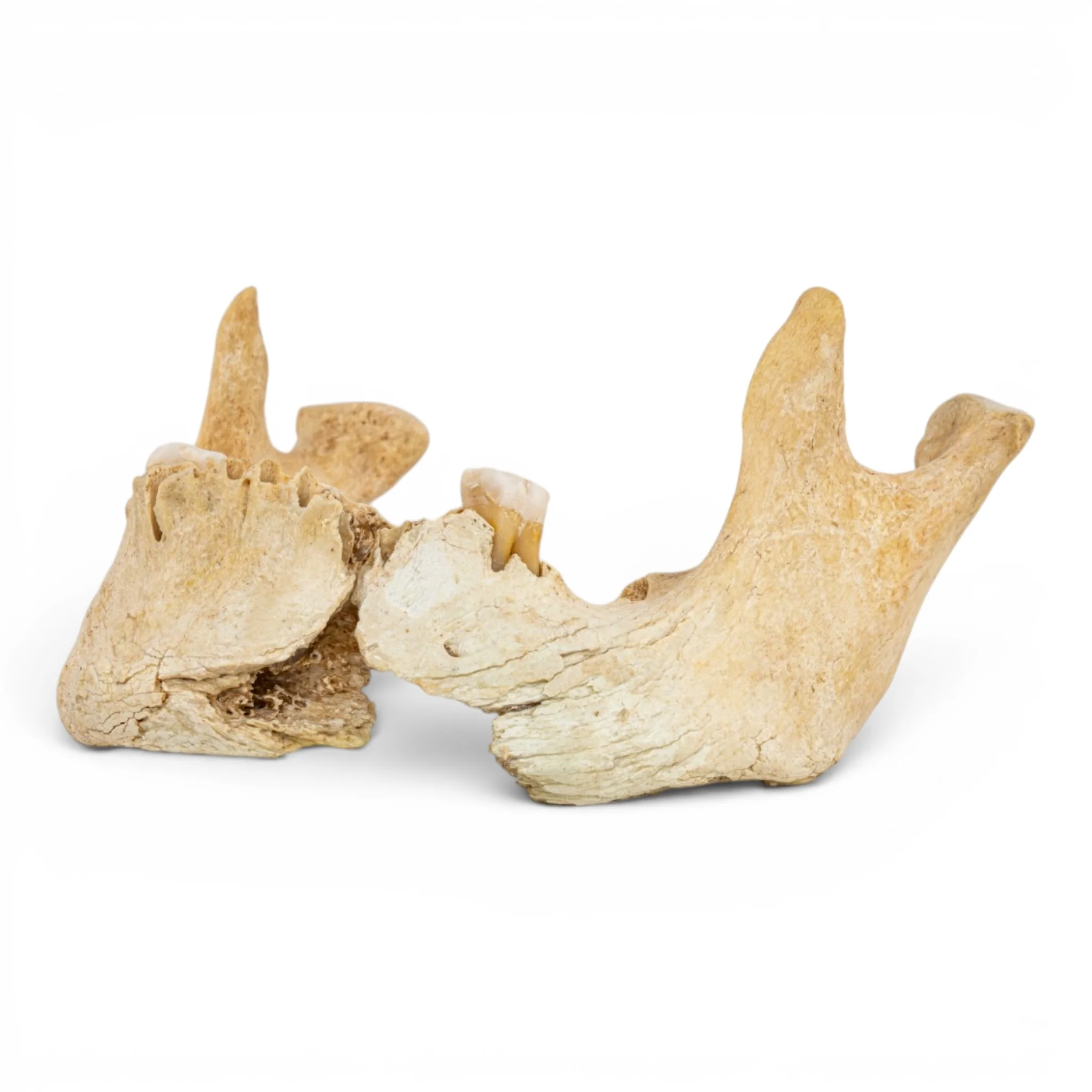 Real Human Mandible - Pathology - Set Of 3 - Image 7