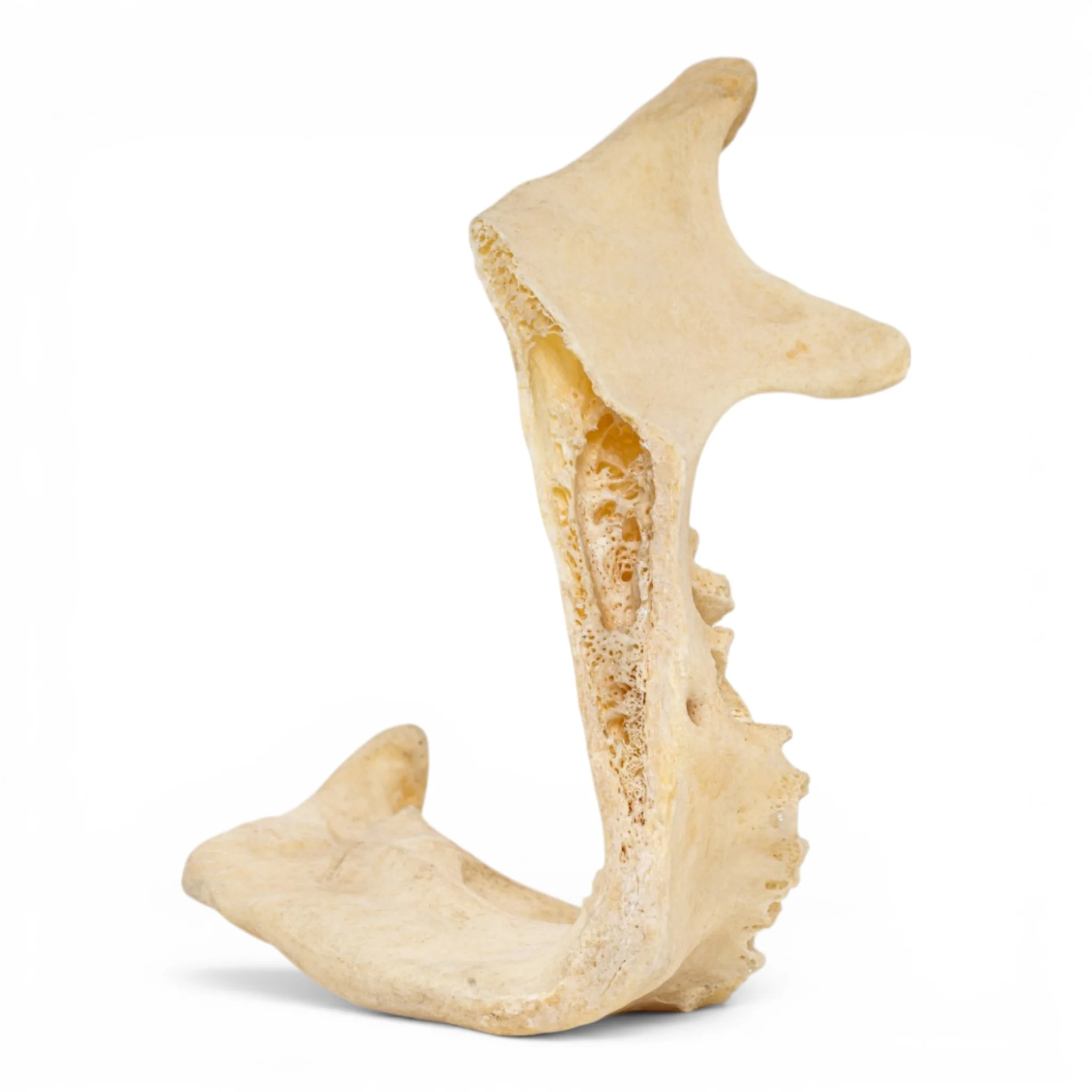 Real Human Mandible - Pathology - Set Of 3 - Image 8