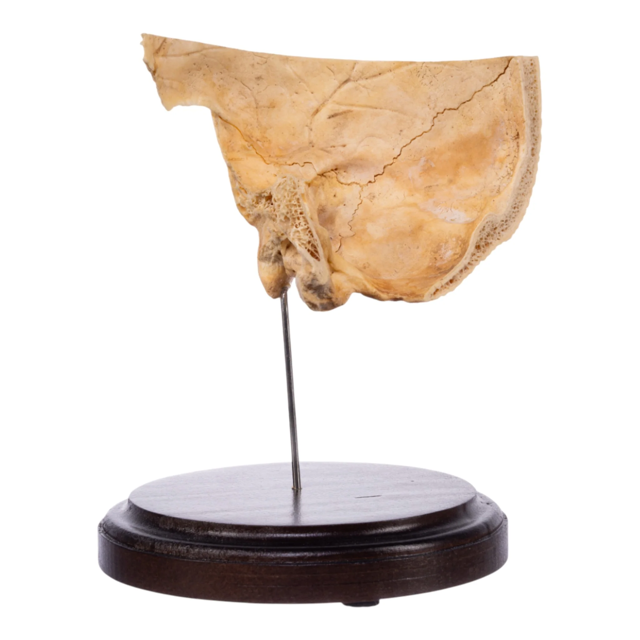 Real Human Partial Skull on Stand - Image 3