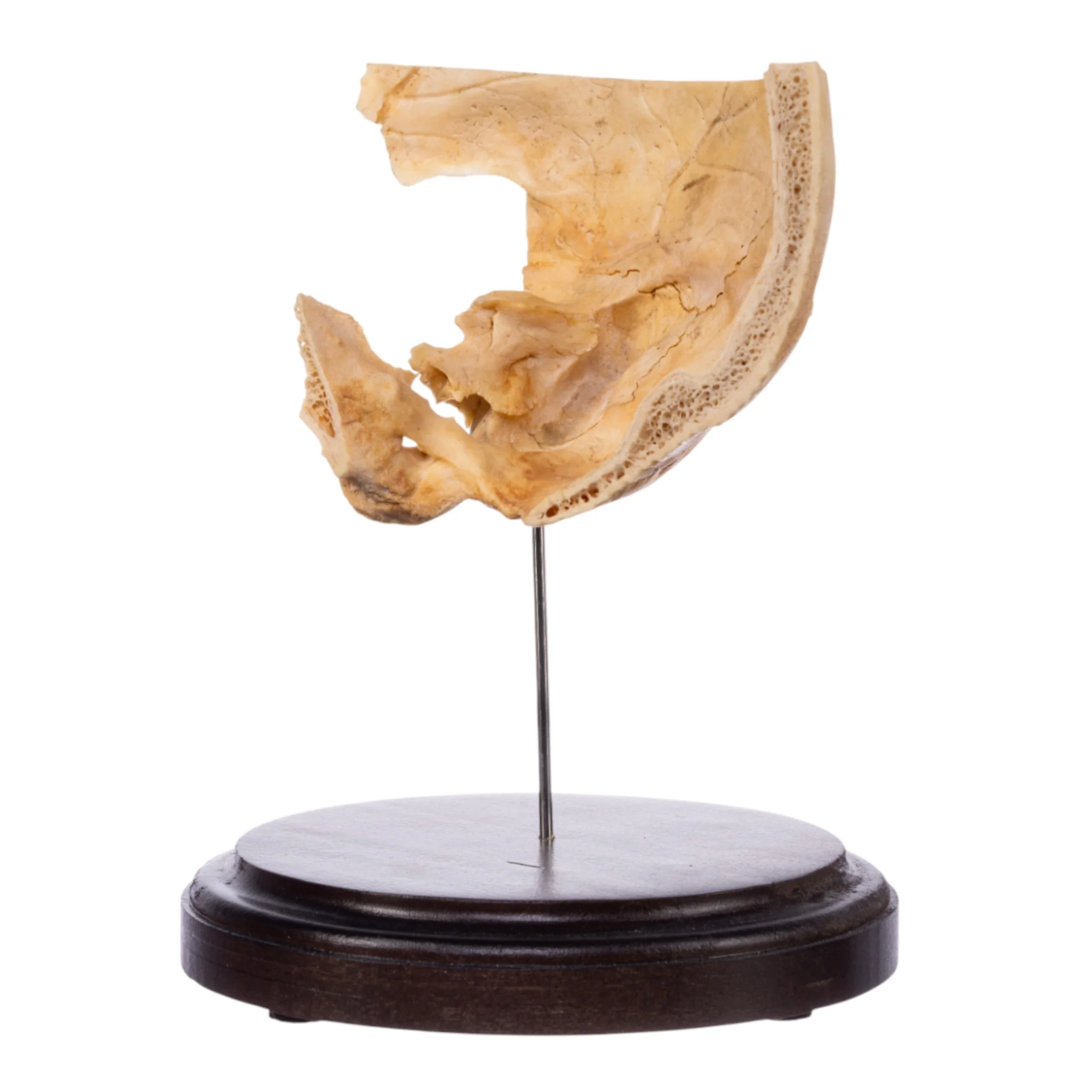 Real Human Partial Skull on Stand - Image 4