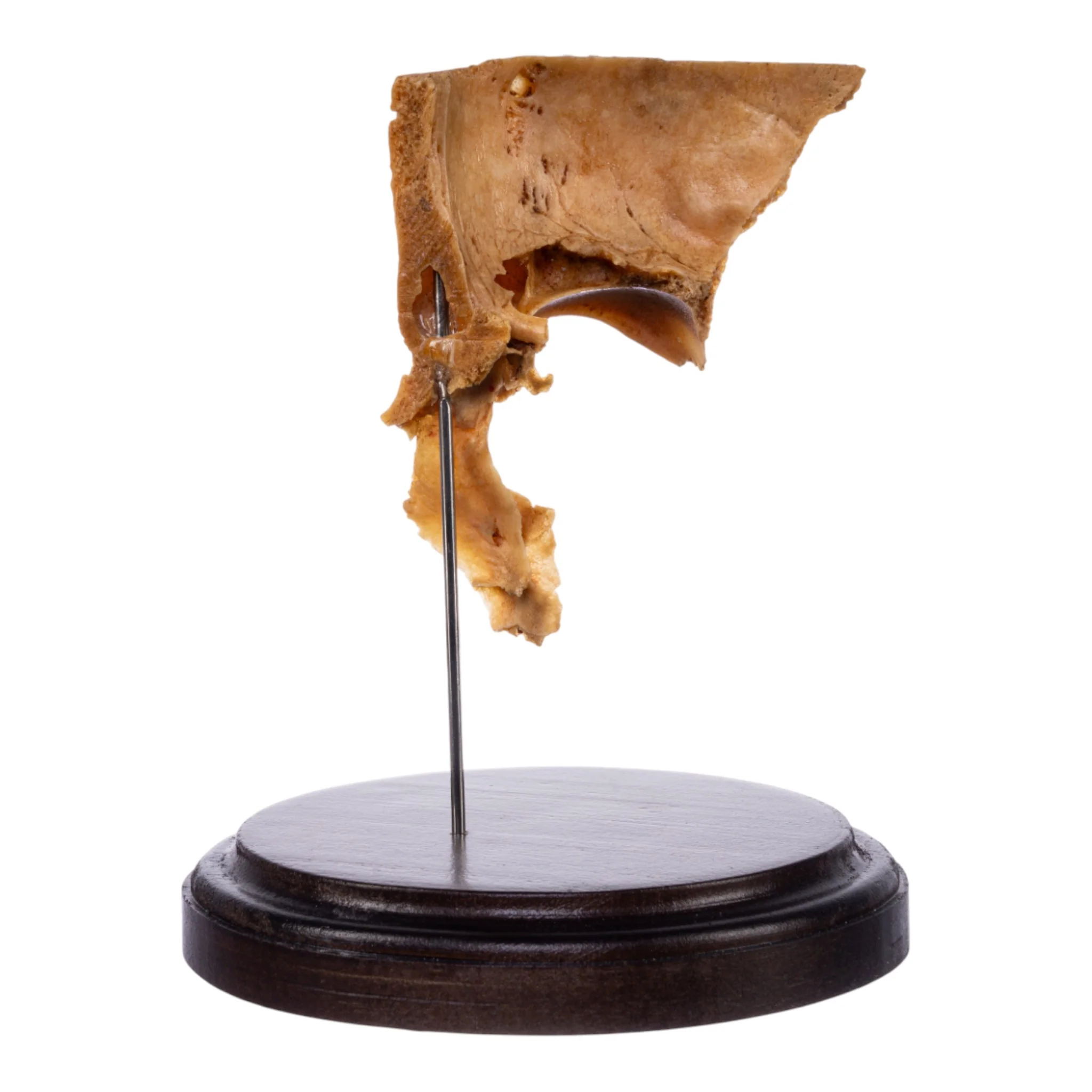 Real Human Partial Skull on Stand - Image 2