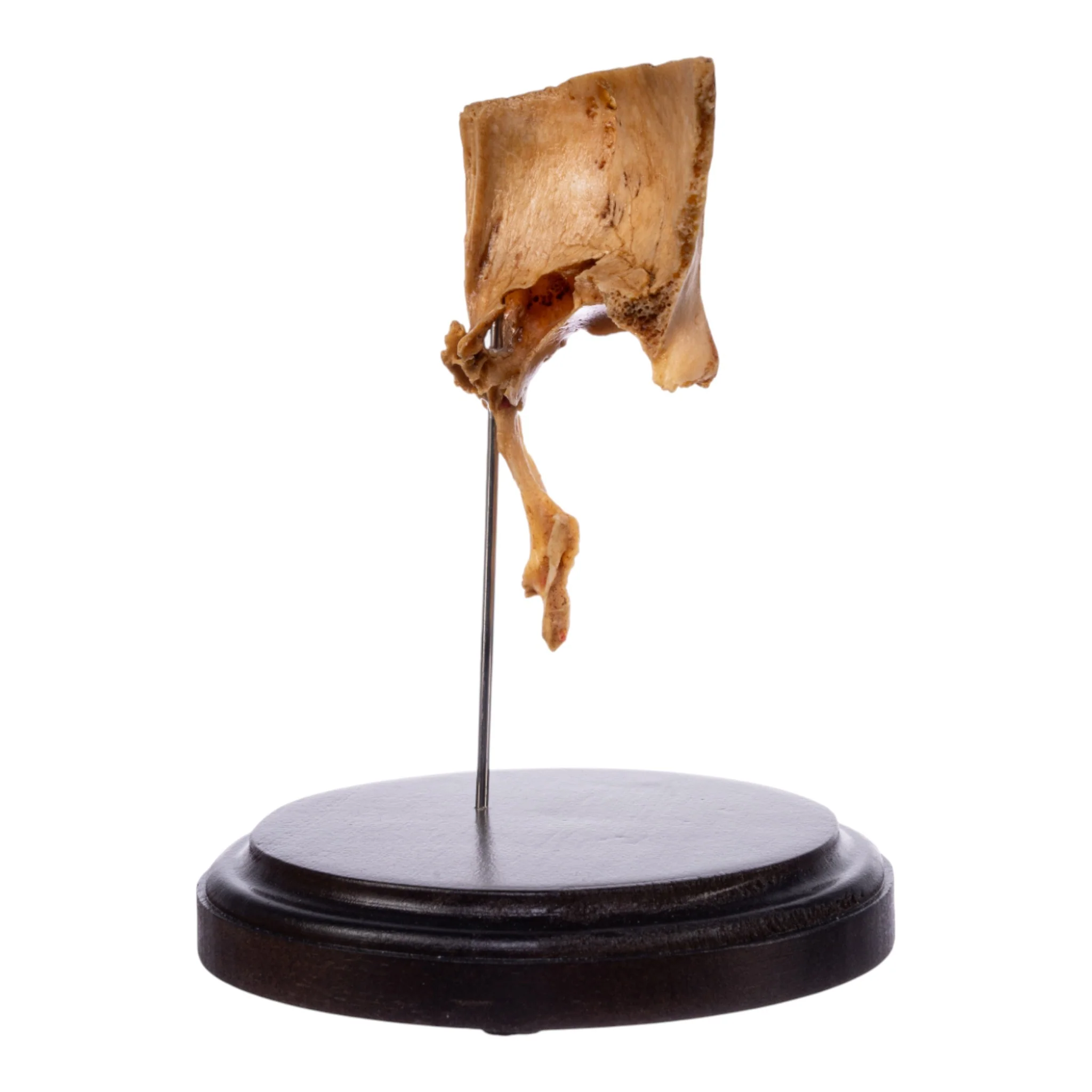 Real Human Partial Skull on Stand - Image 3