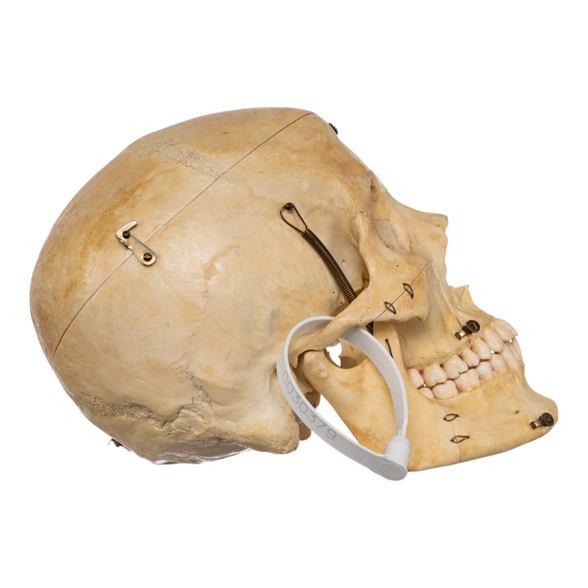 Real Human Skull - Dissected - Image 2