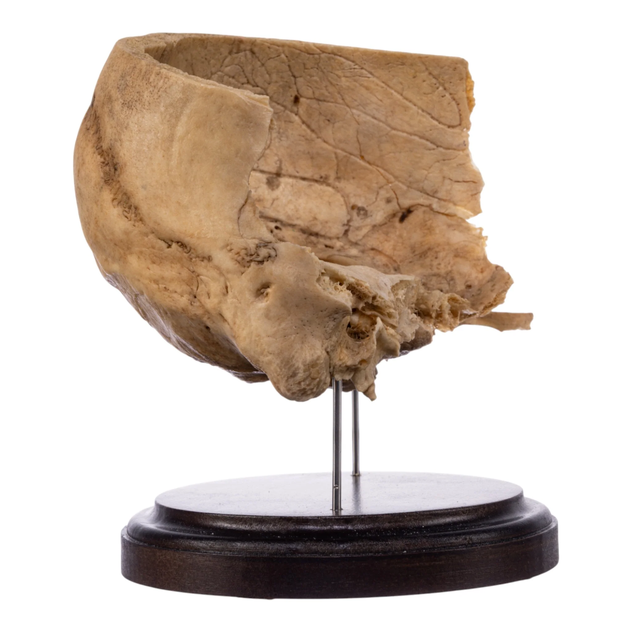 Real Human Partial Skull on Stand - Image 2