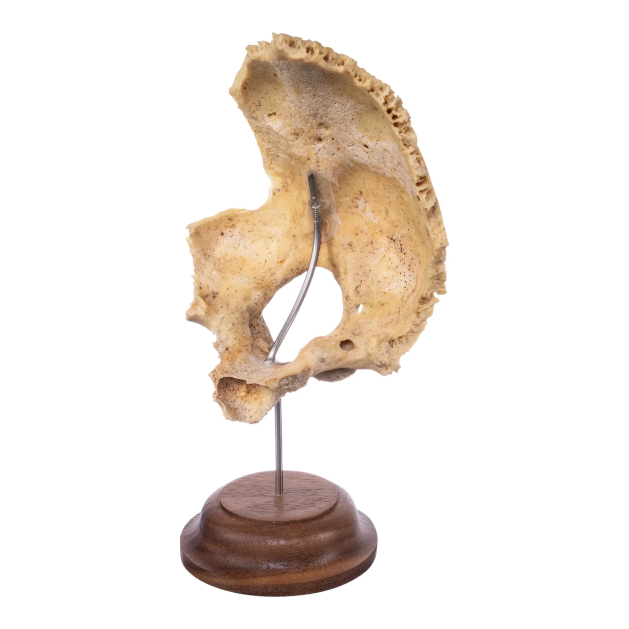 Real Human Partial Skull on Stand - Image 5