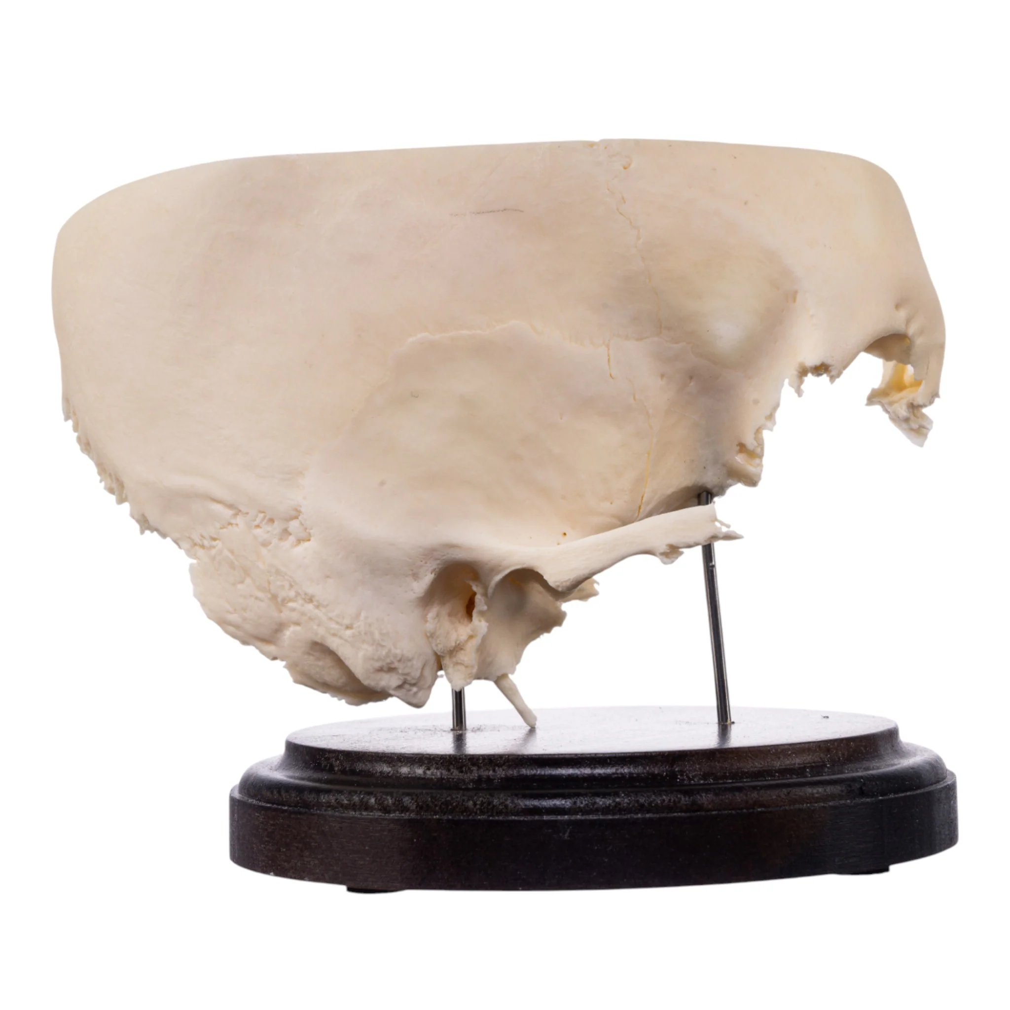 Real Human Partial Skull on Stand - Image 2