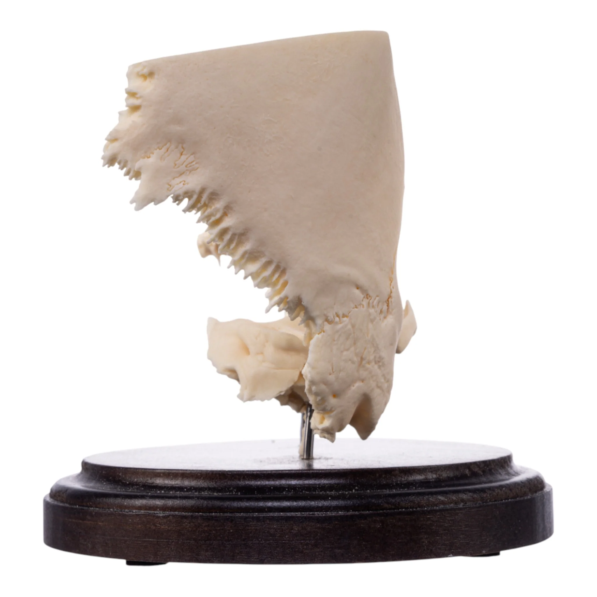 Real Human Partial Skull on Stand - Image 3