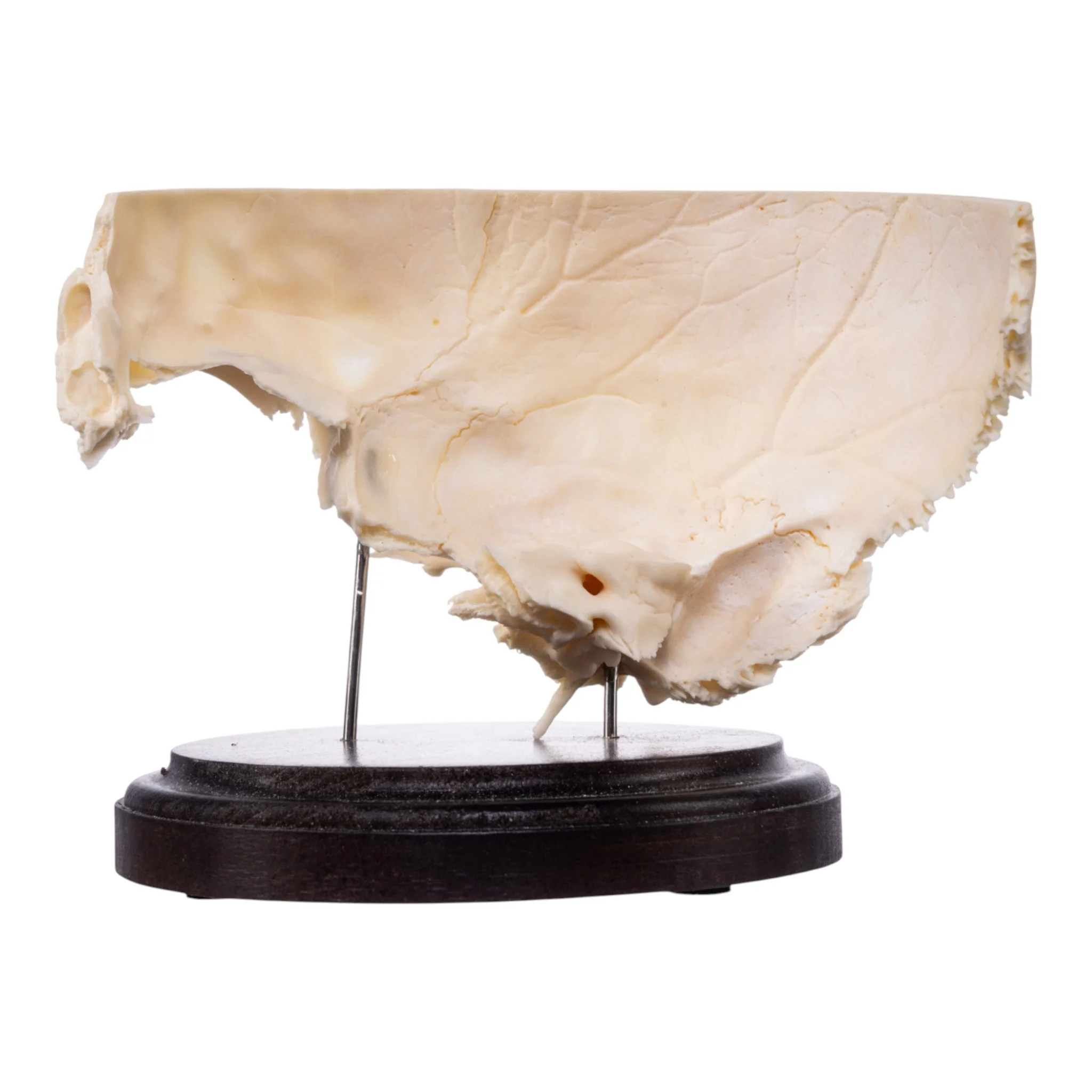 Real Human Partial Skull on Stand - Image 4