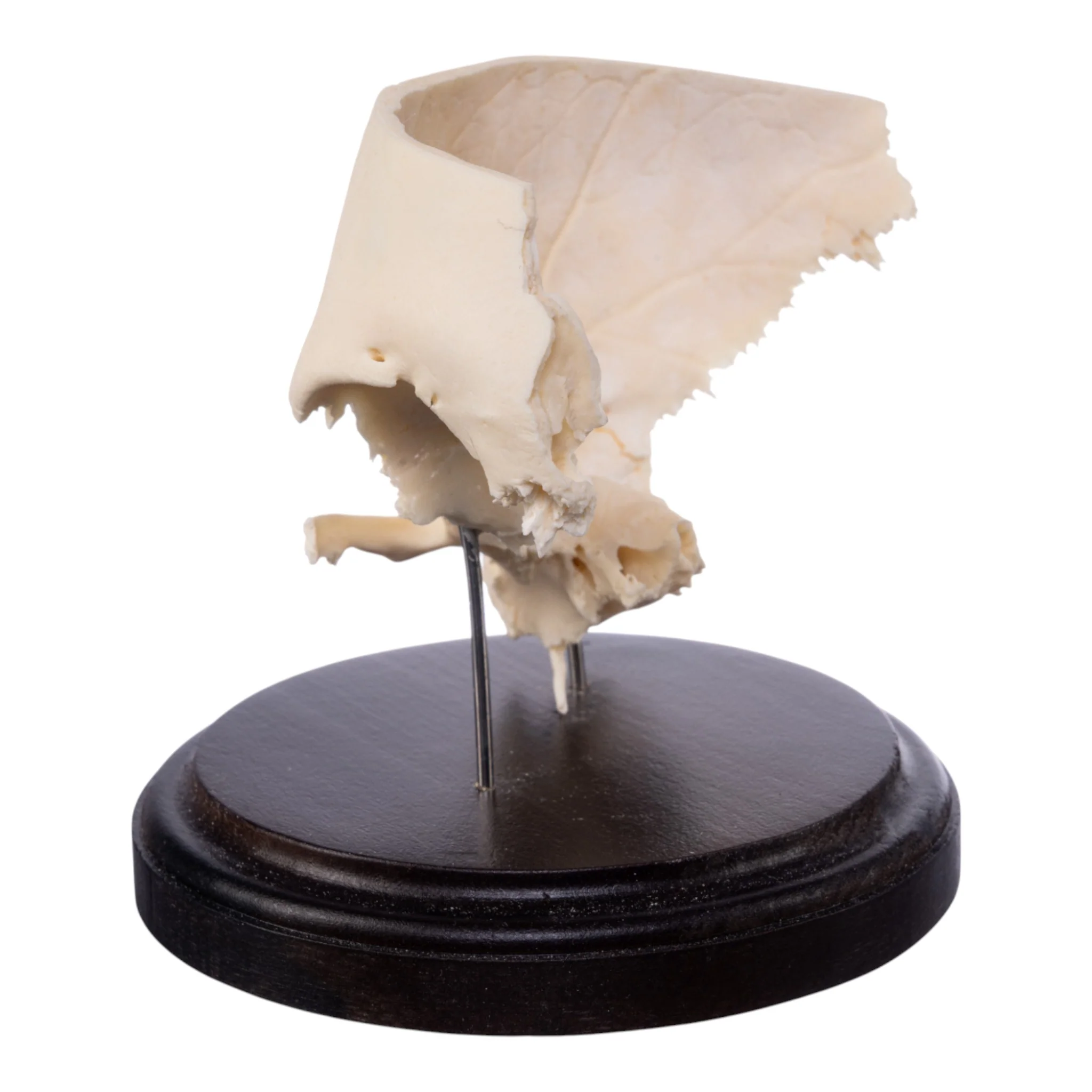 Real Human Partial Skull on Stand - Image 5