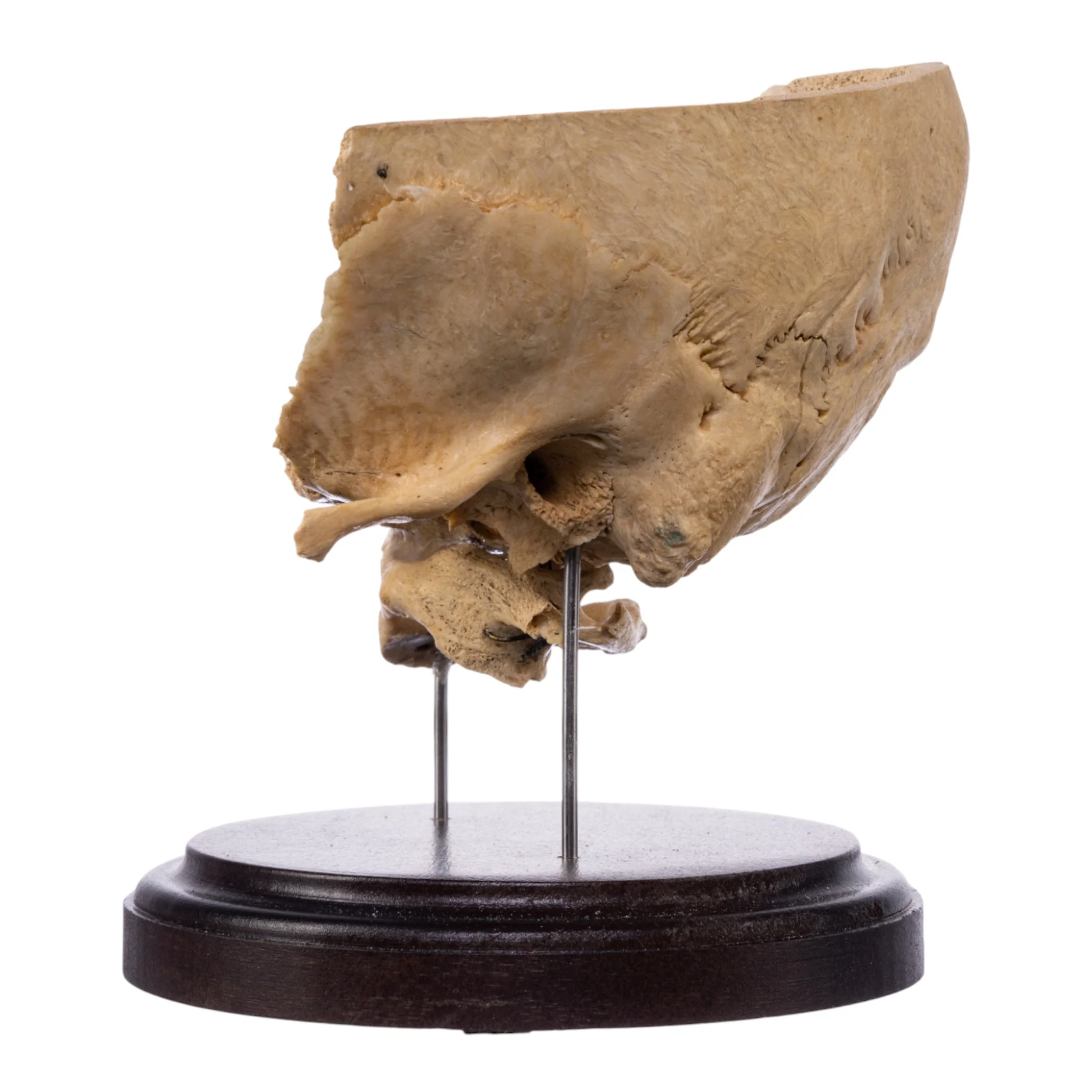 Real Human Partial Skull on Stand - Image 3