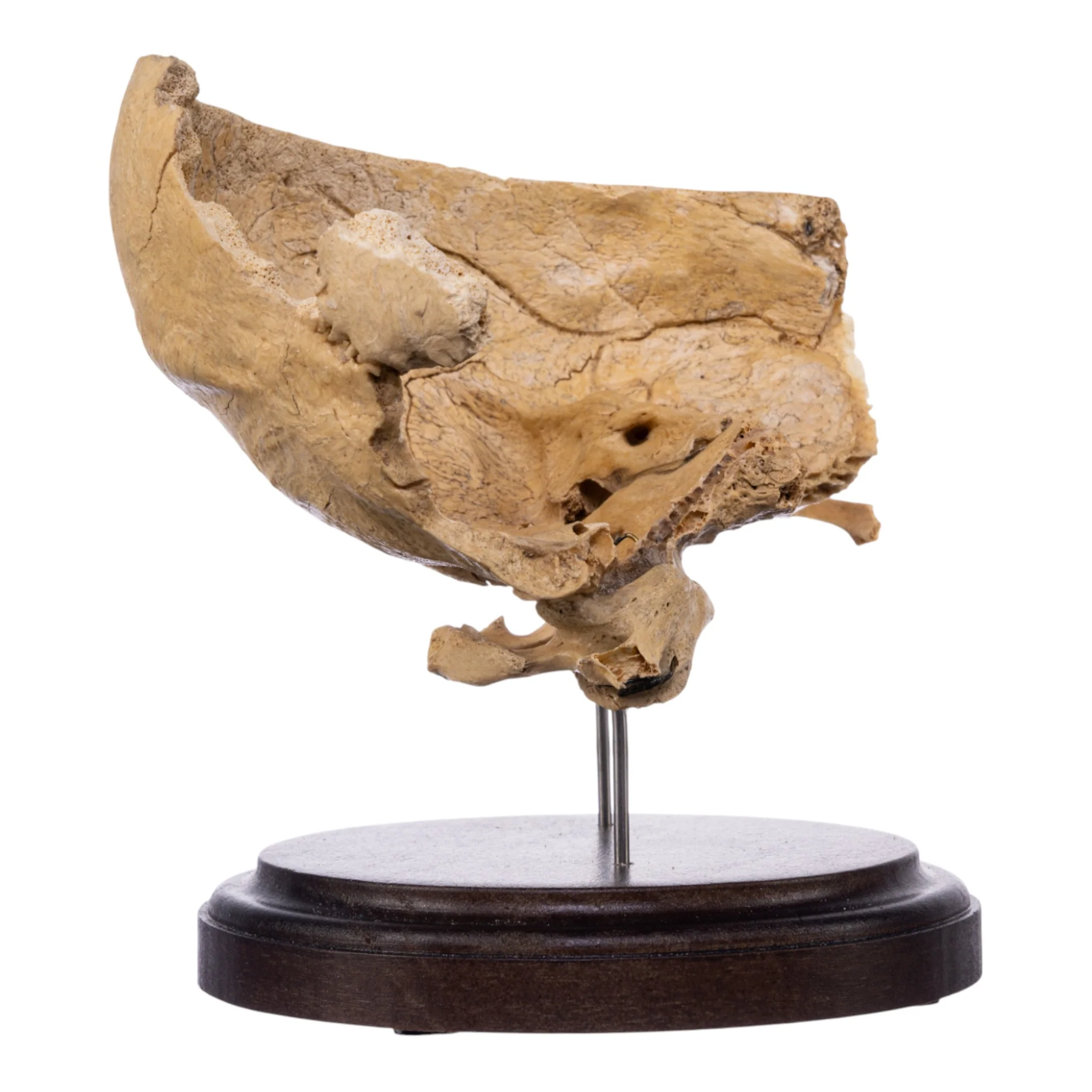 Real Human Partial Skull on Stand - Image 5