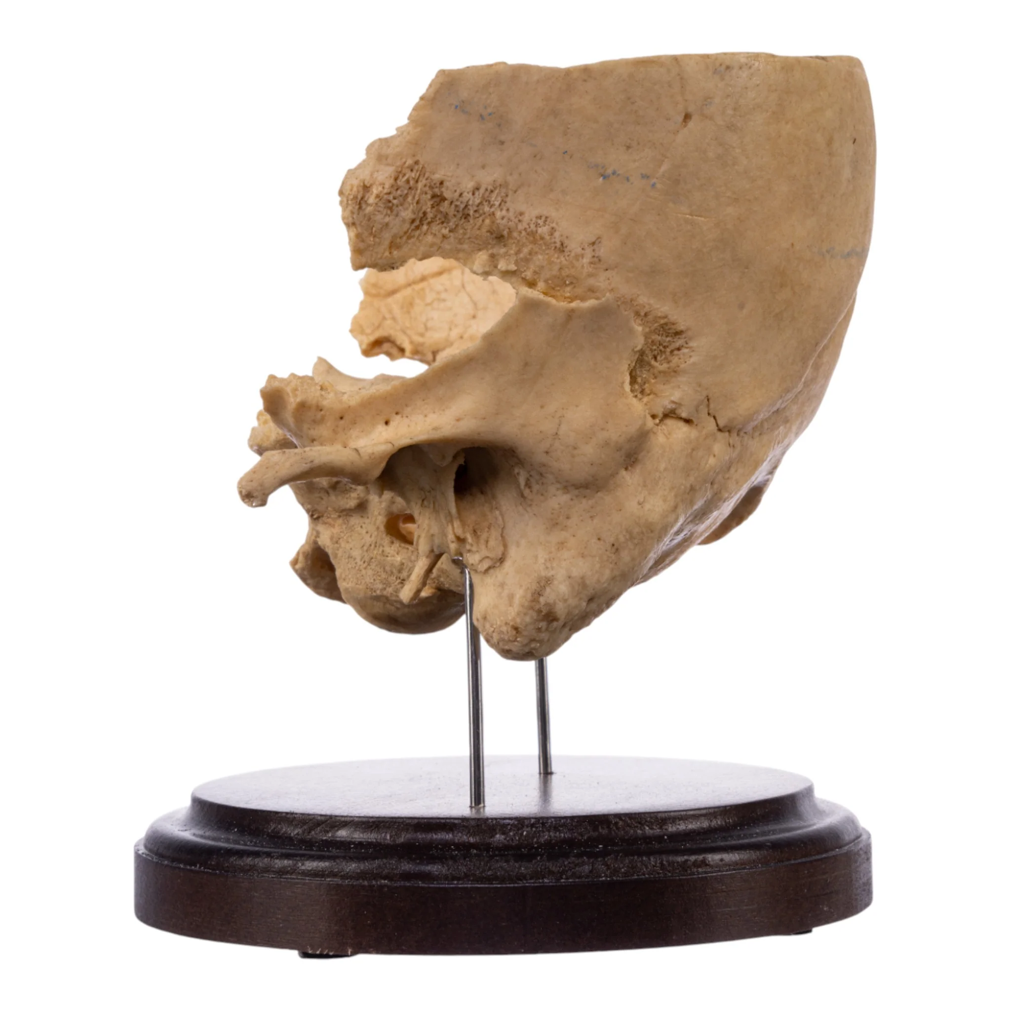 Real Human Partial Skull on Stand - Image 4