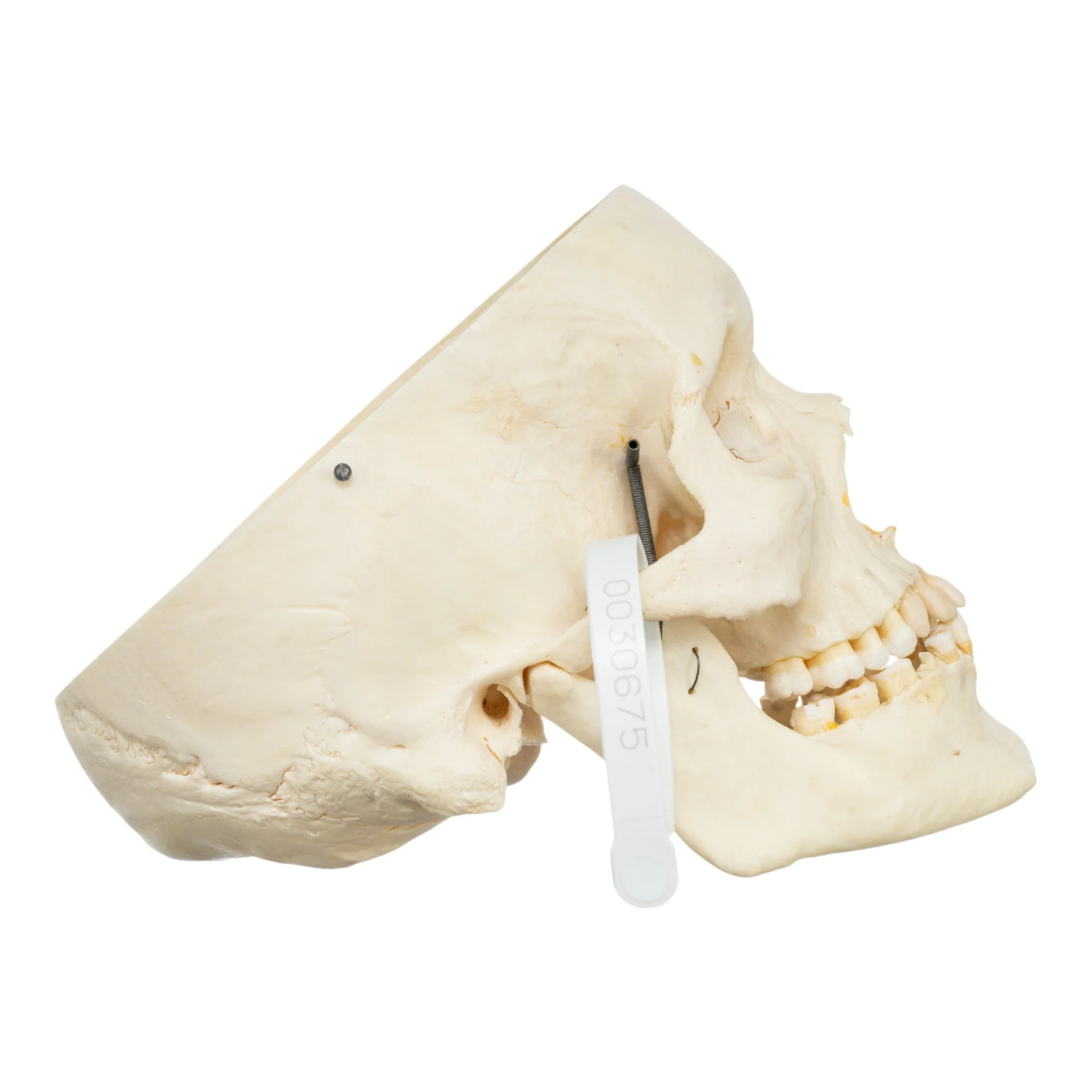 Real Human Skull - Partial - Image 2