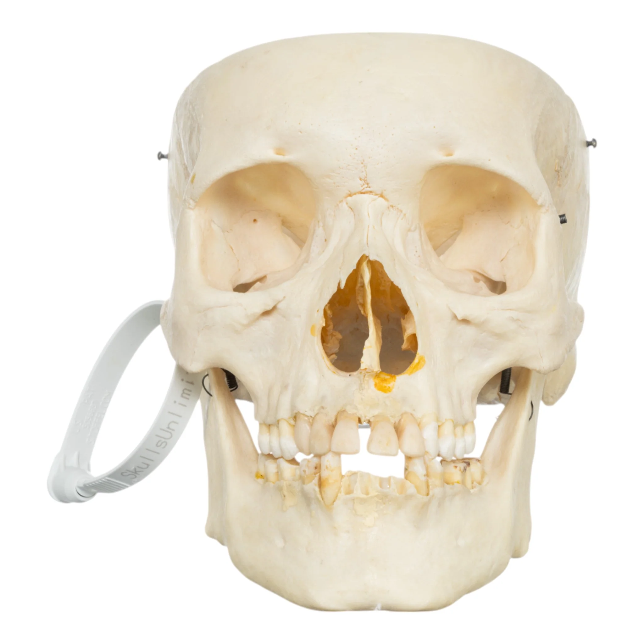Real Human Skull - Partial - Image 3