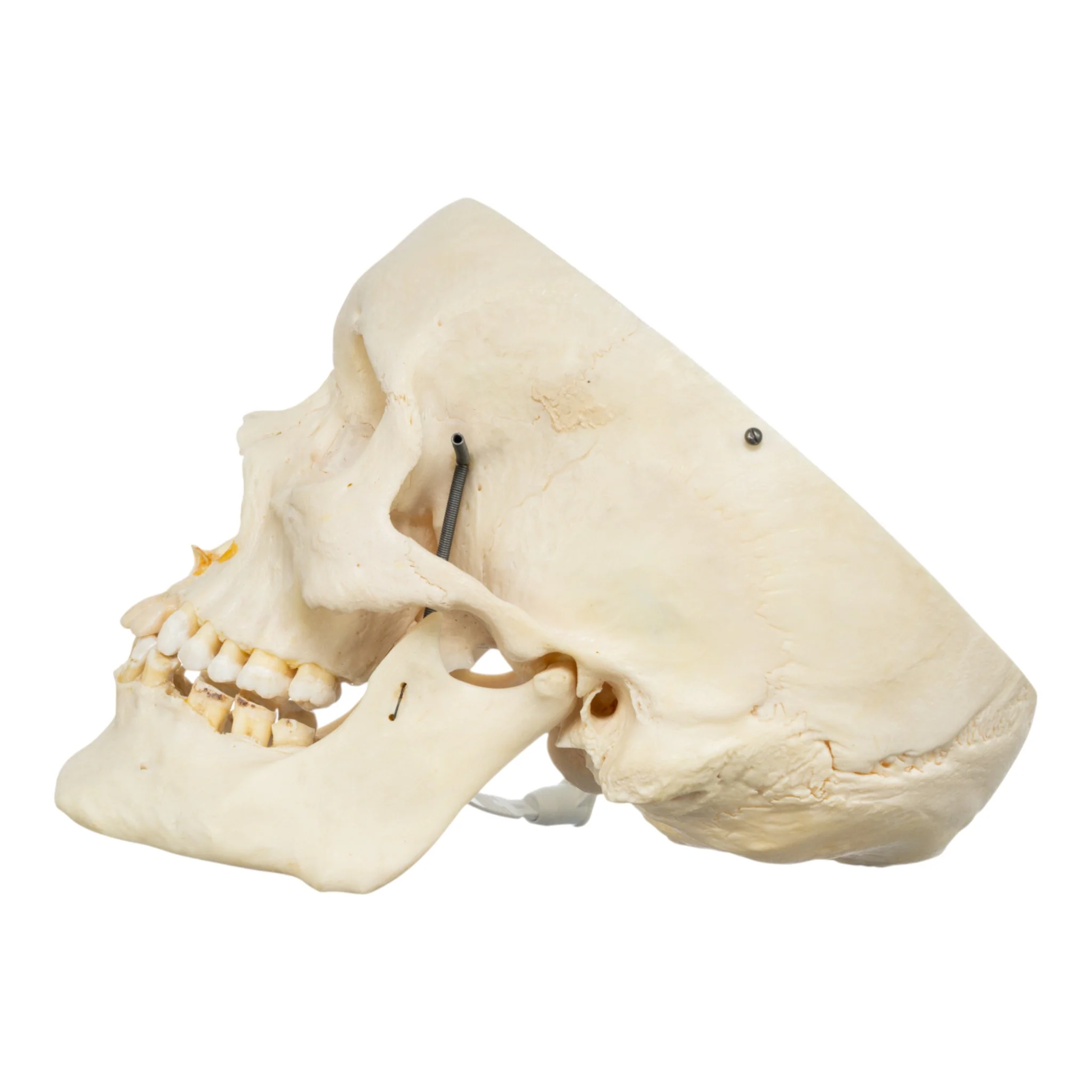 Real Human Skull - Partial - Image 4