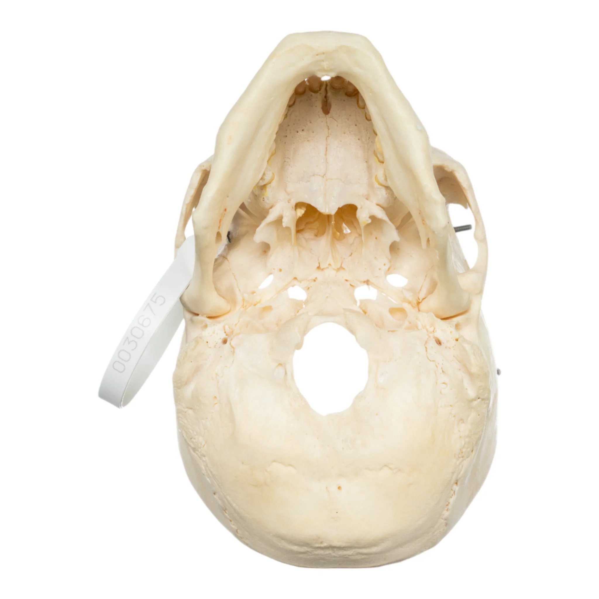 Real Human Skull - Partial - Image 6