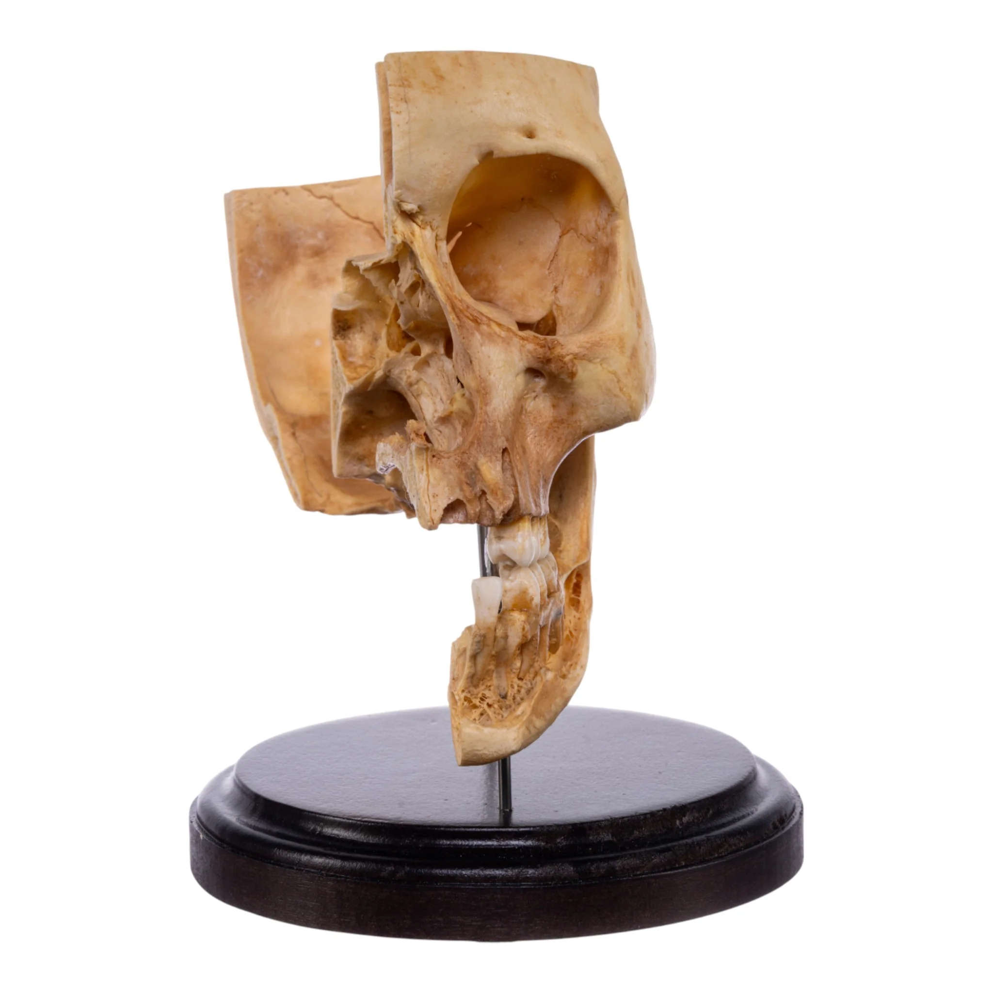 Real Human Partial Skull on Stand - Image 3