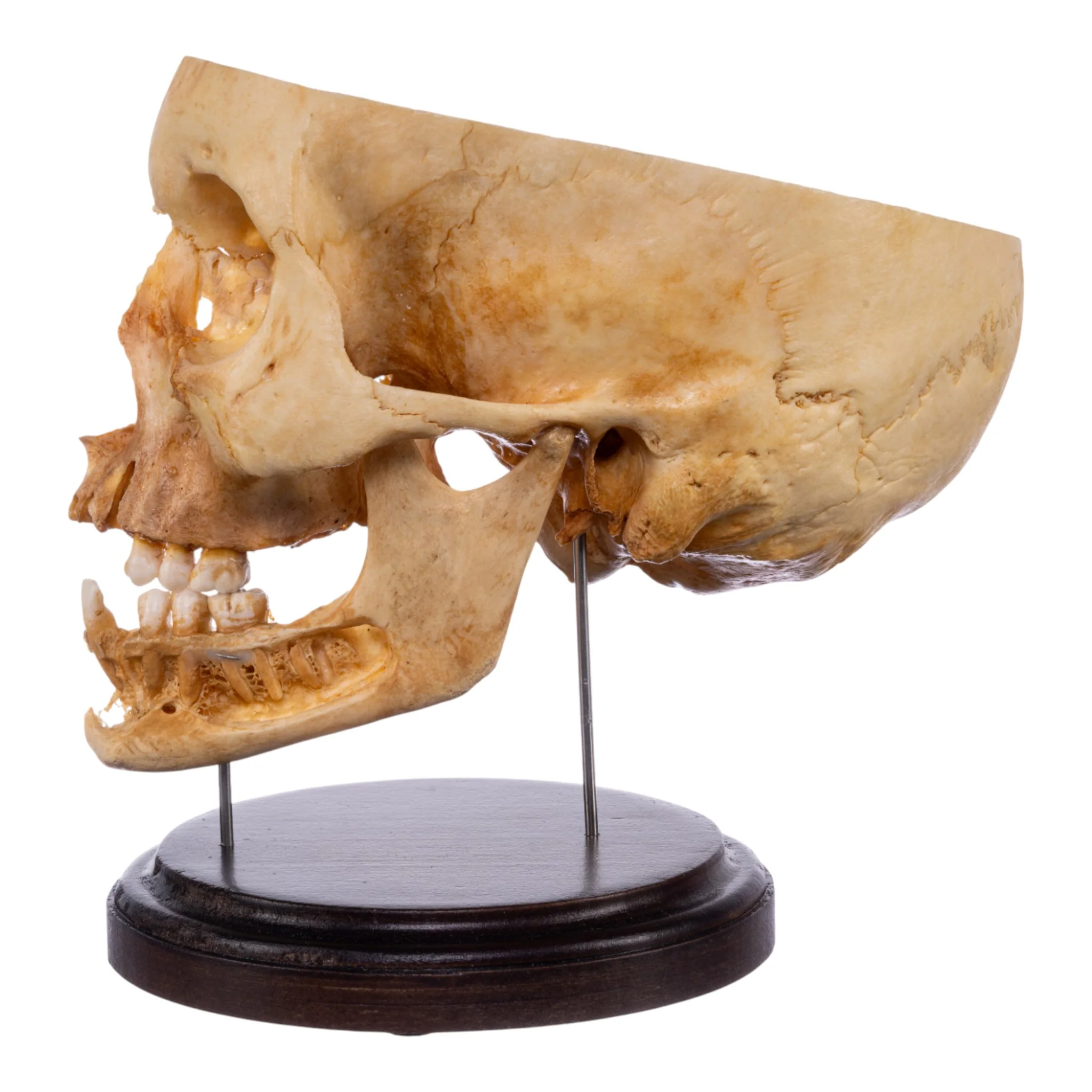 Real Human Partial Skull on Stand - Image 4