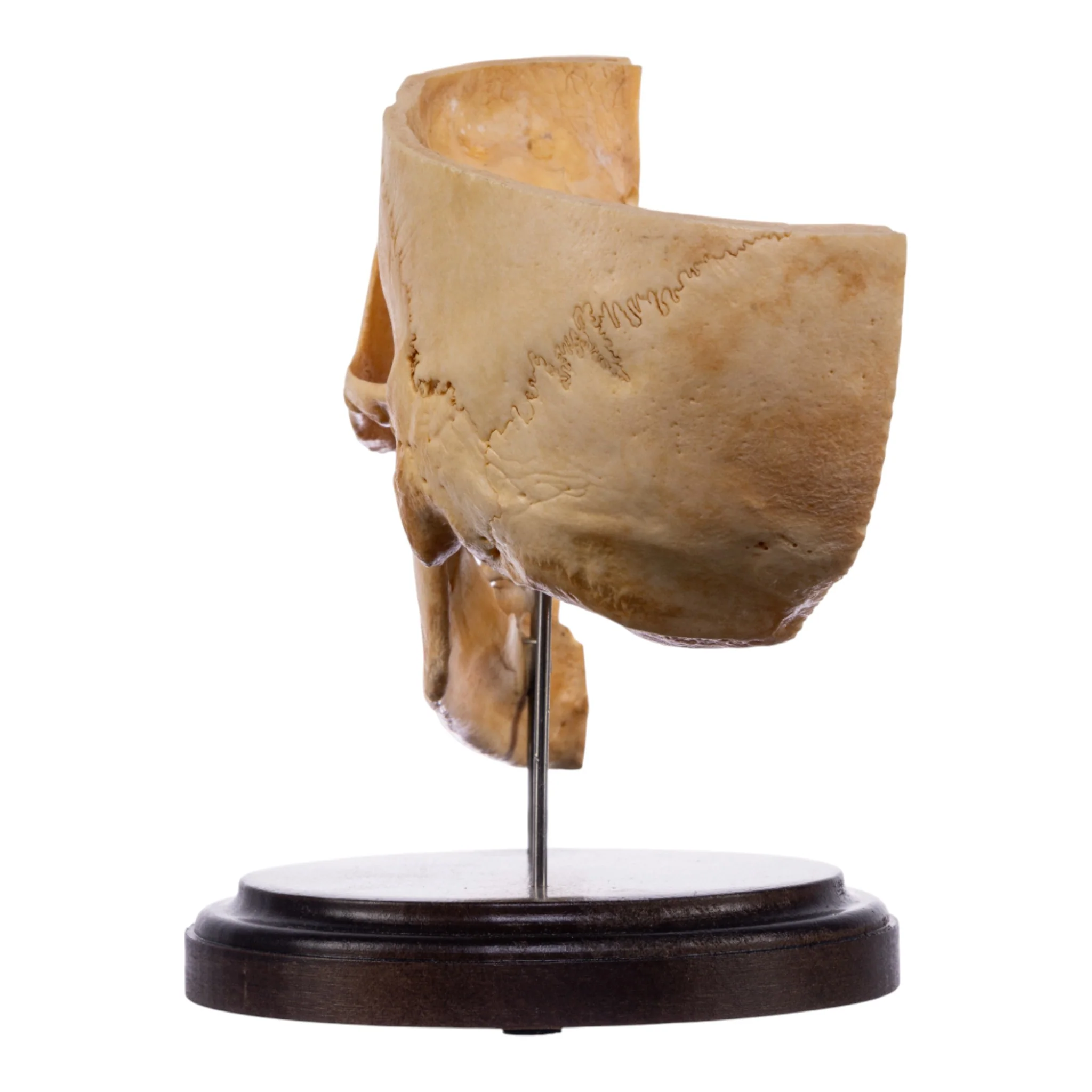 Real Human Partial Skull on Stand - Image 5