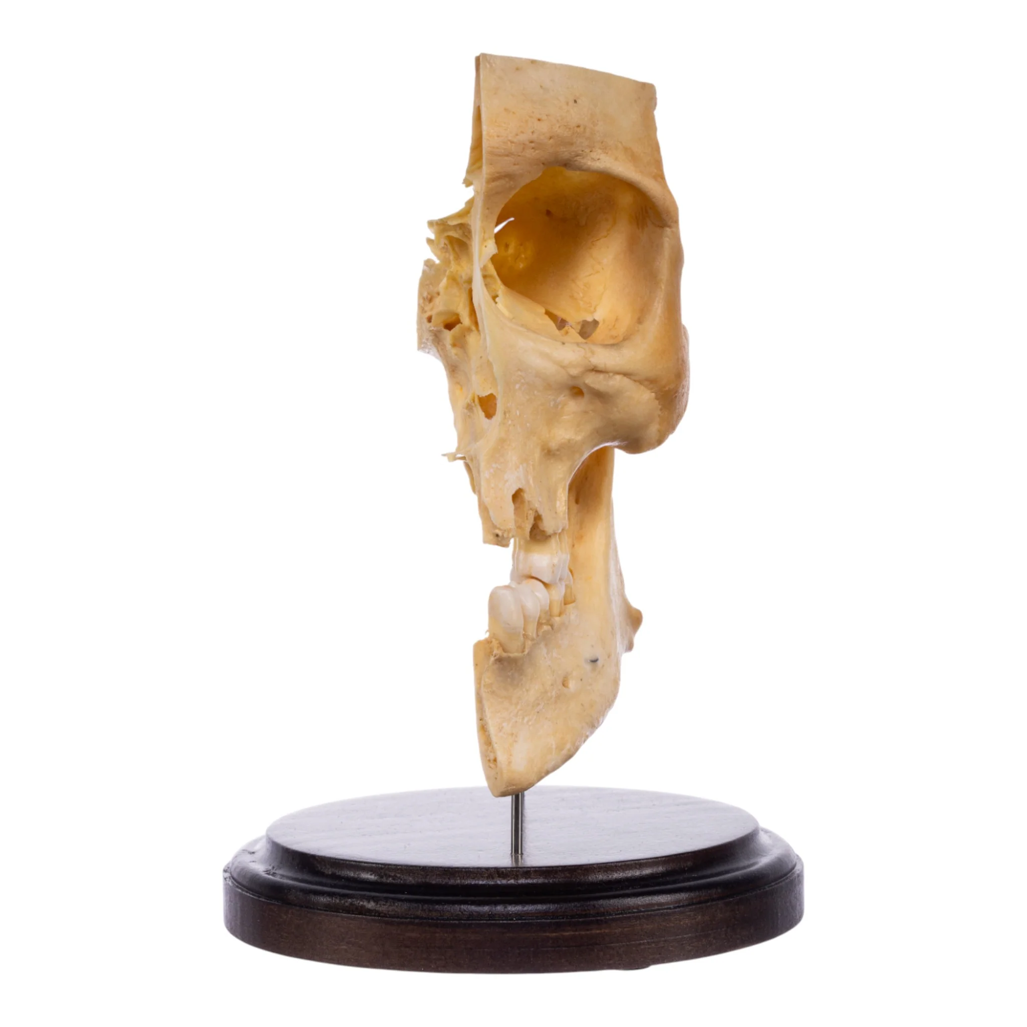 Real Human Partial Skull on Stand - Image 3