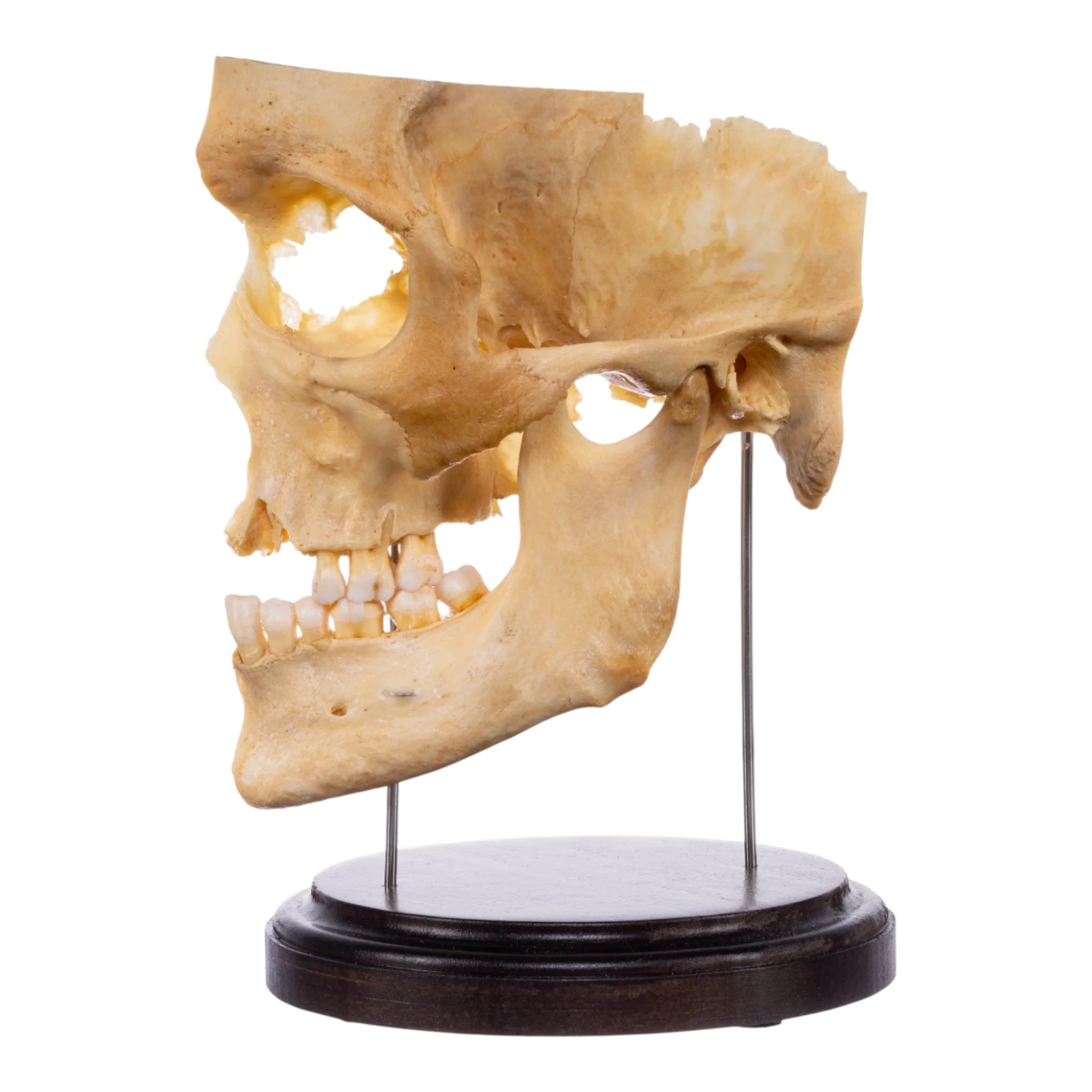Real Human Partial Skull on Stand - Image 4