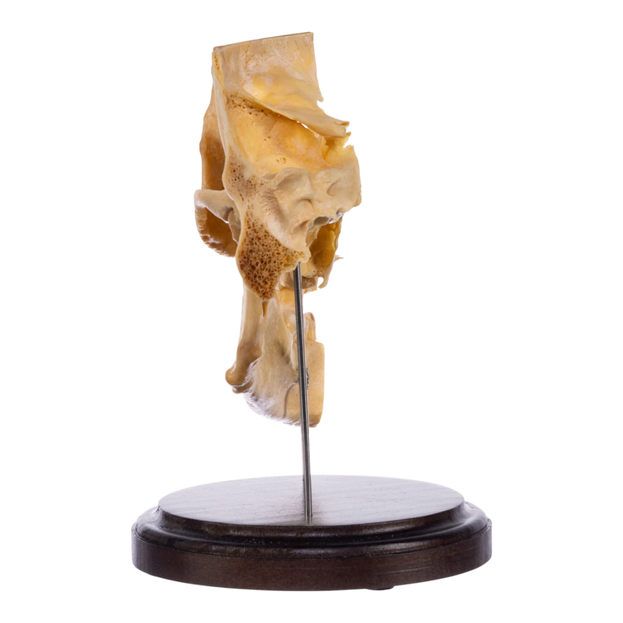 Real Human Partial Skull on Stand - Image 5