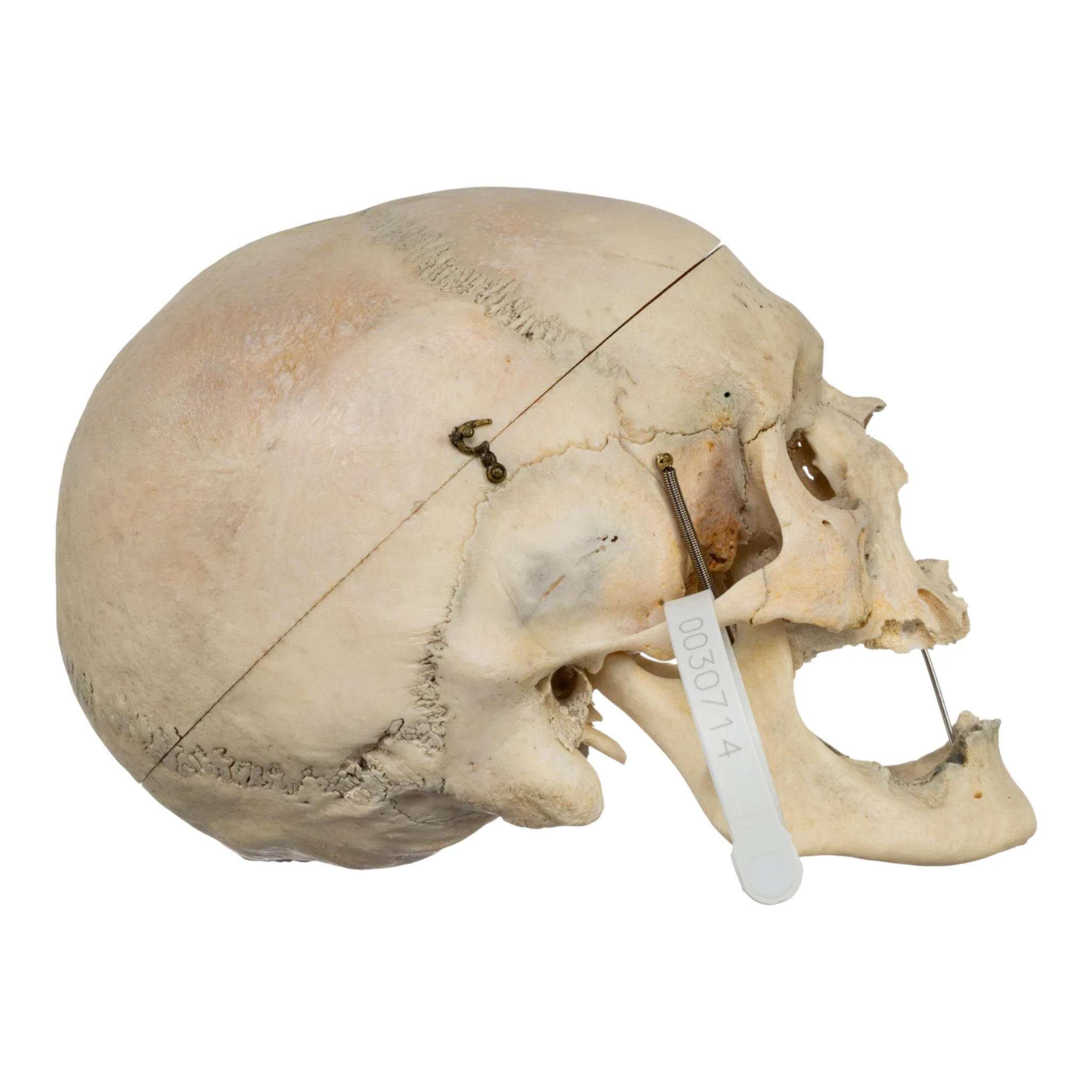 Real Human Skull - Image 2