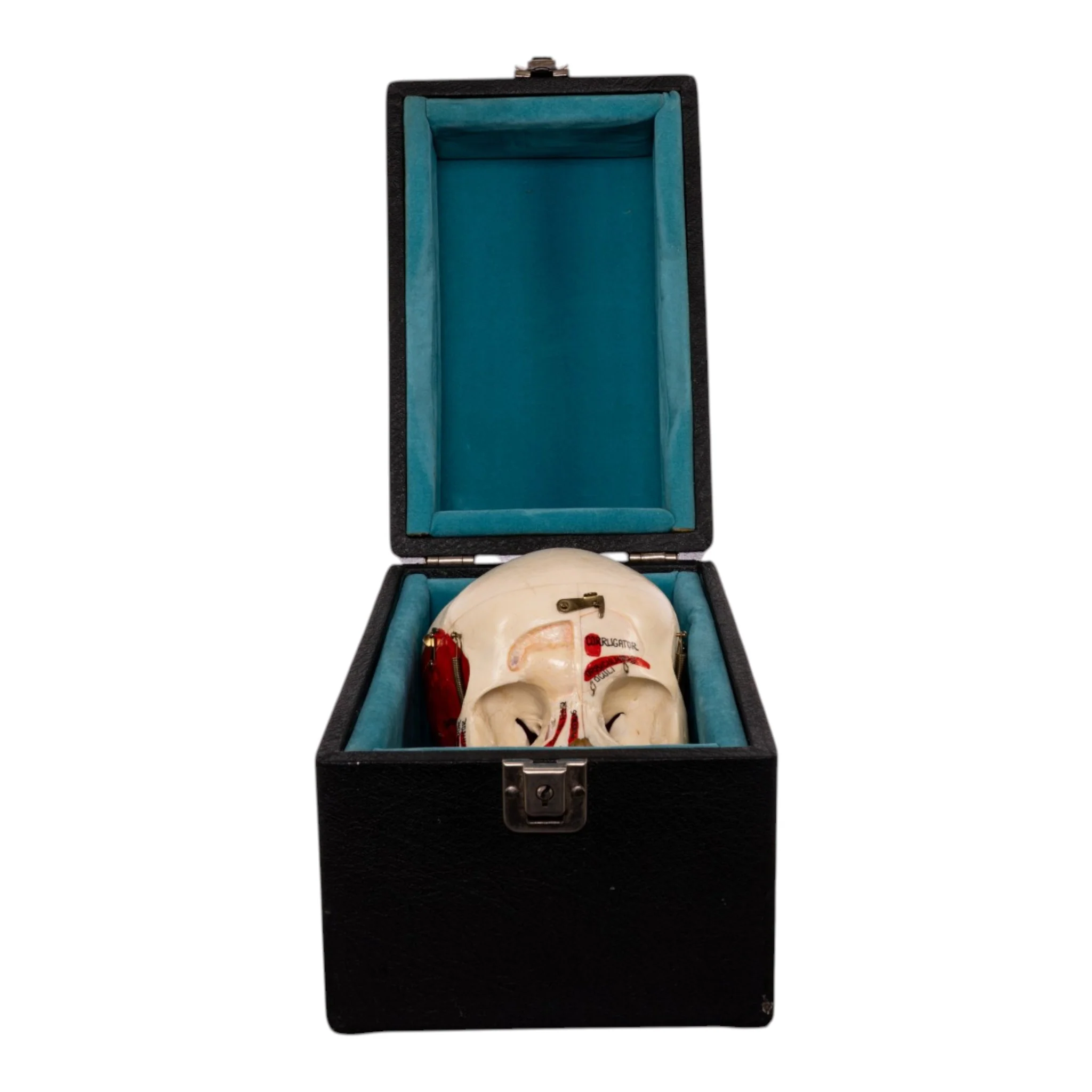 Real Human Dissected Skull in Carrying Case - Image 11