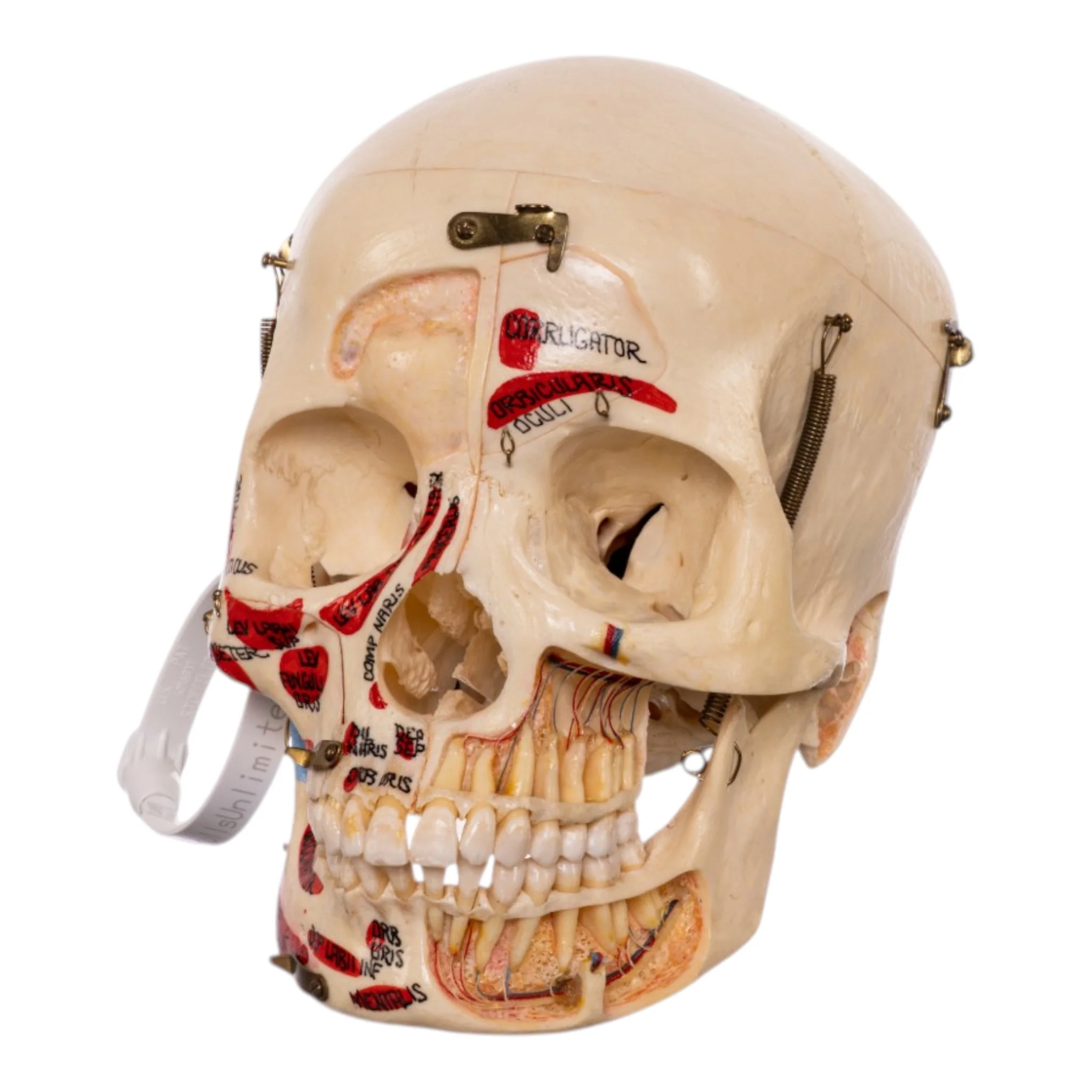Real Human Dissected Skull in Carrying Case - Image 2
