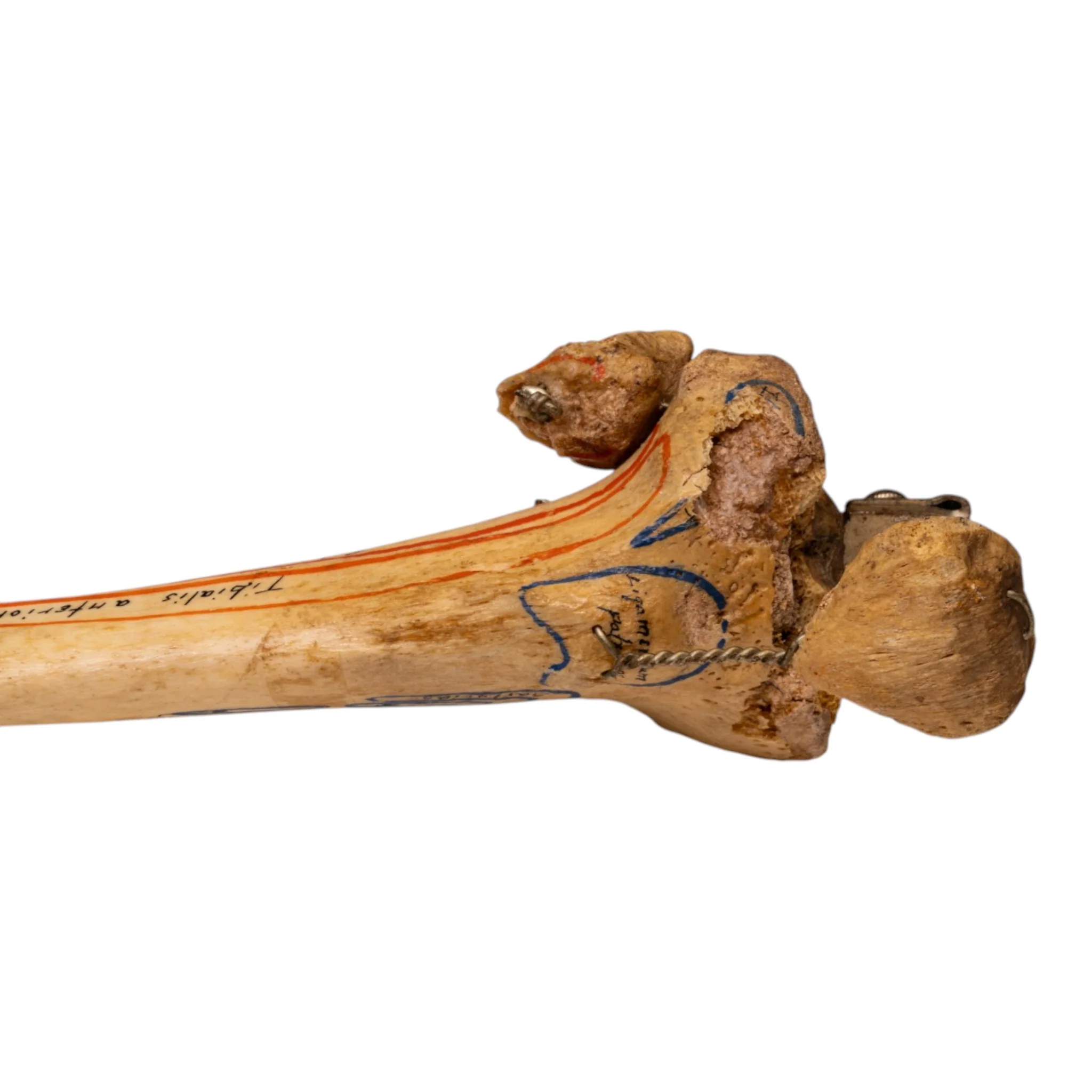 Real Human Right Partial Leg - Articulated - Image 5