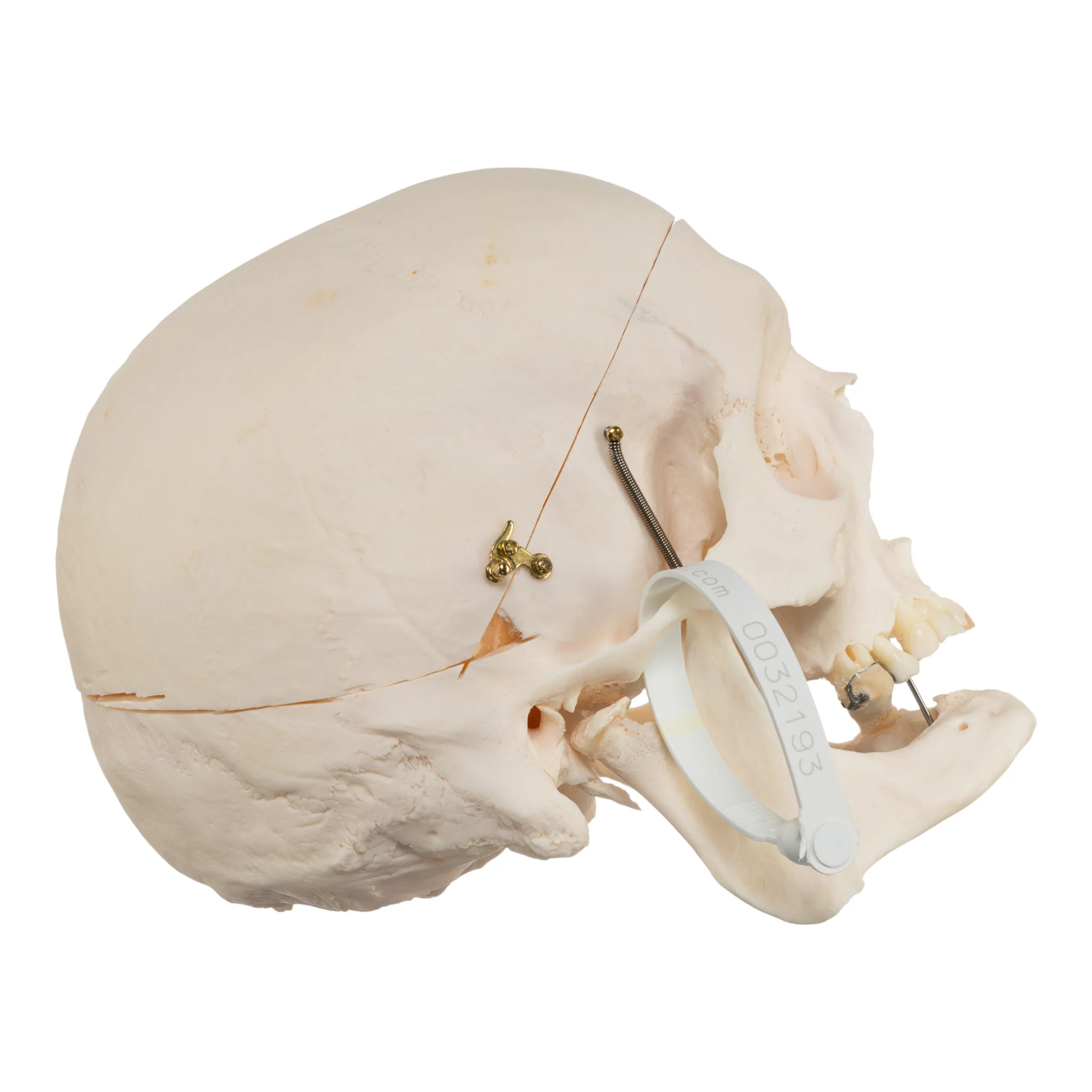 Real Research Quality Human Skull - Pathology - Image 2