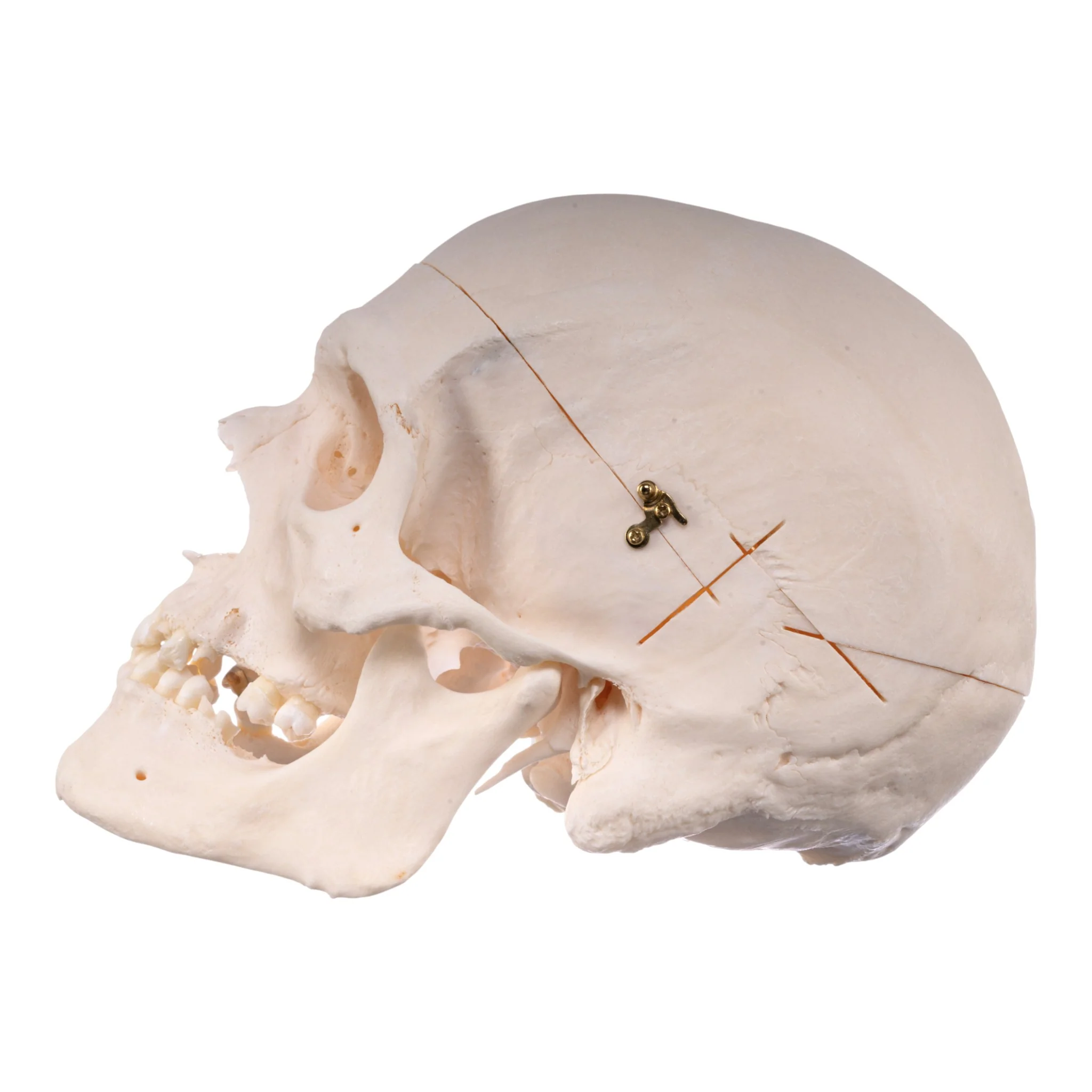 Real Research Quality Human Skull - Image 4