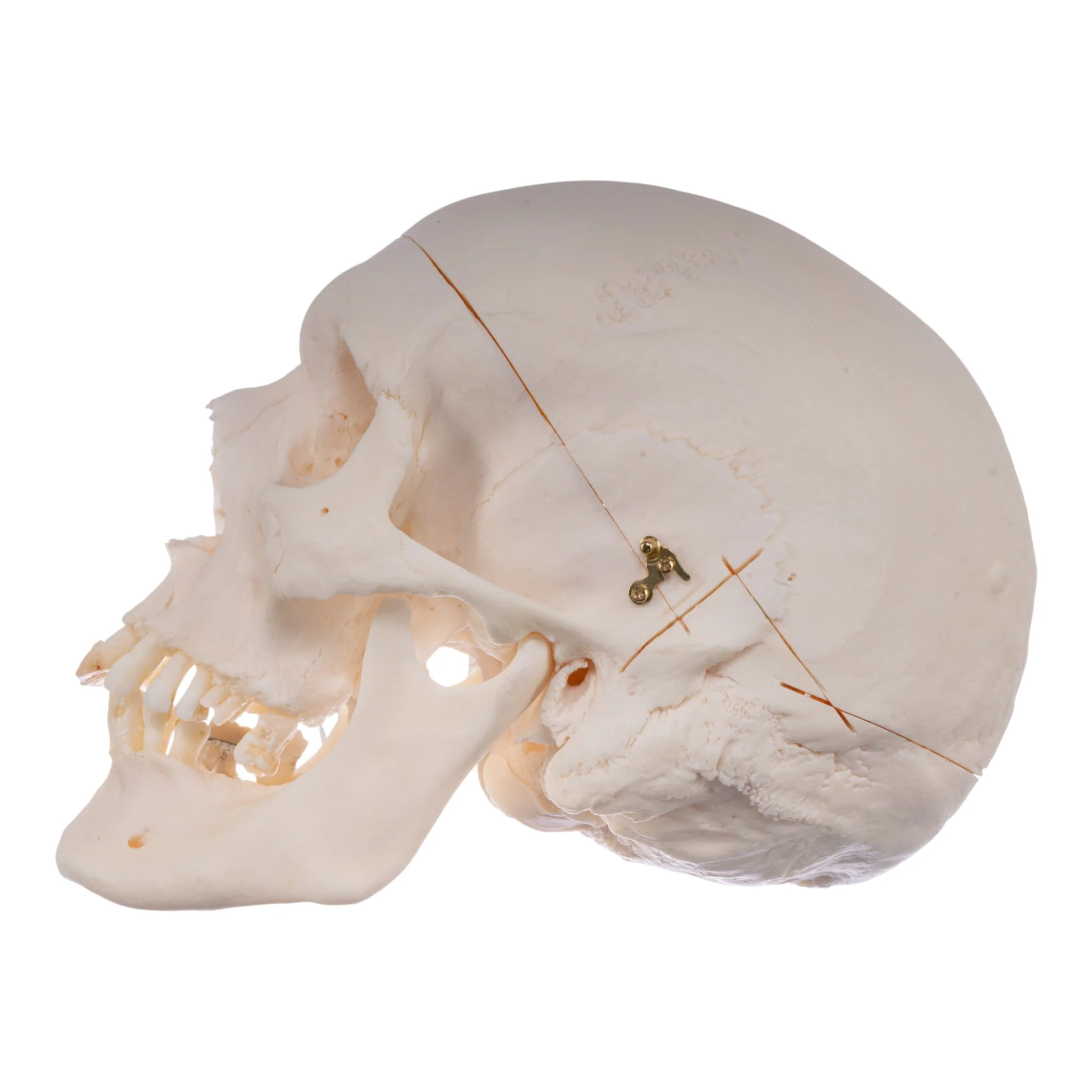 Real Research Quality Human Skull - Image 4