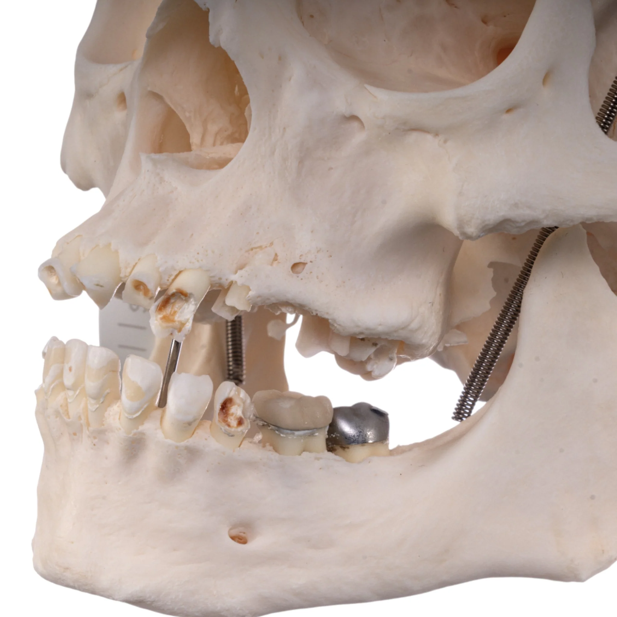 Real Research Quality Human Skull - Image 7