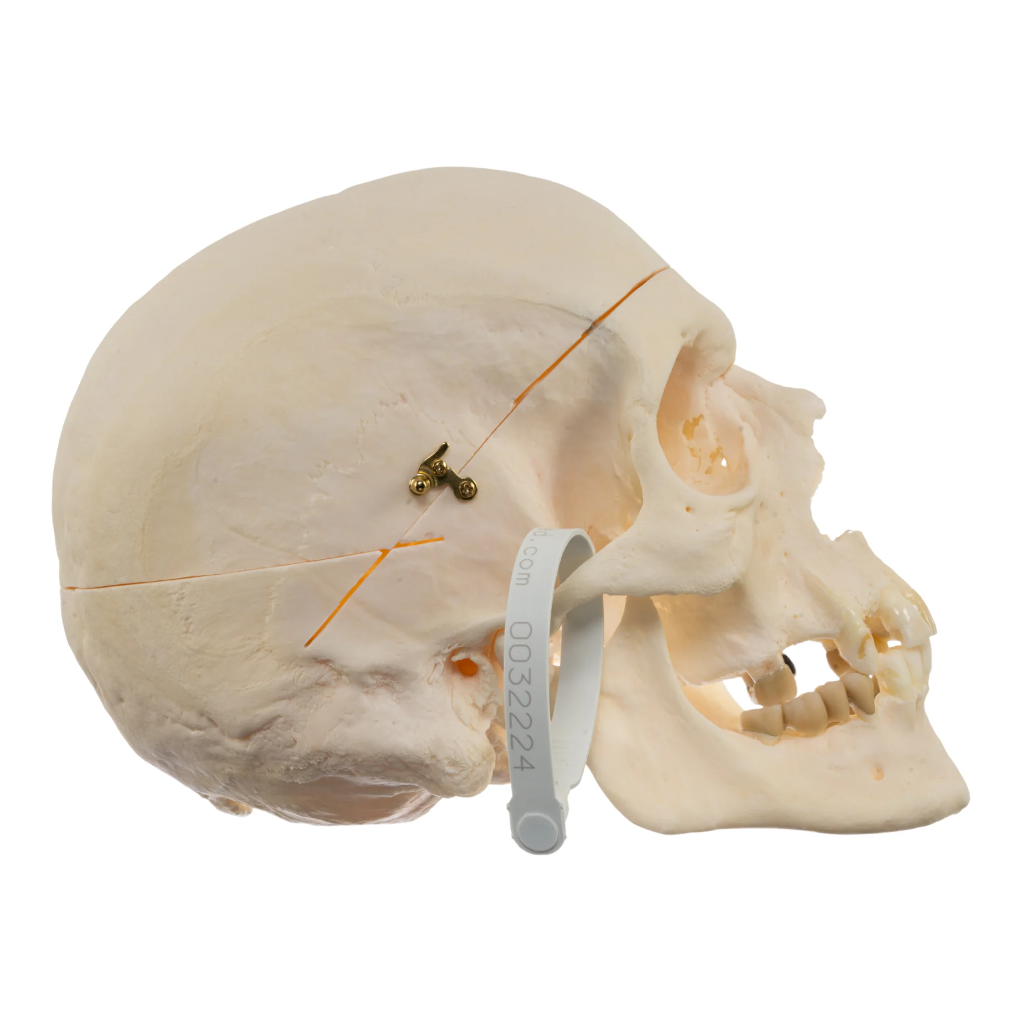 Real Research Quality Human Skull - Pathology - Image 2