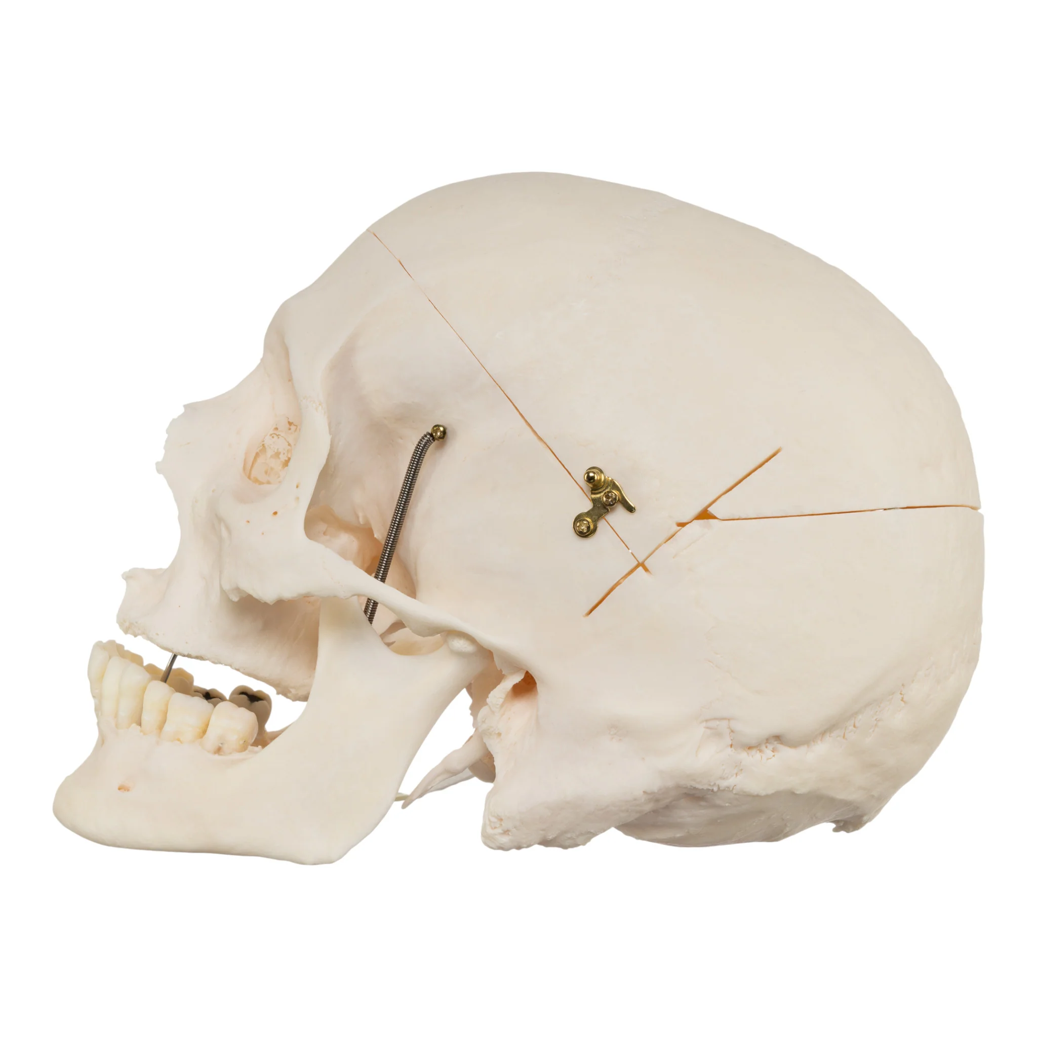 Real Research Quality Human Skull - Image 4