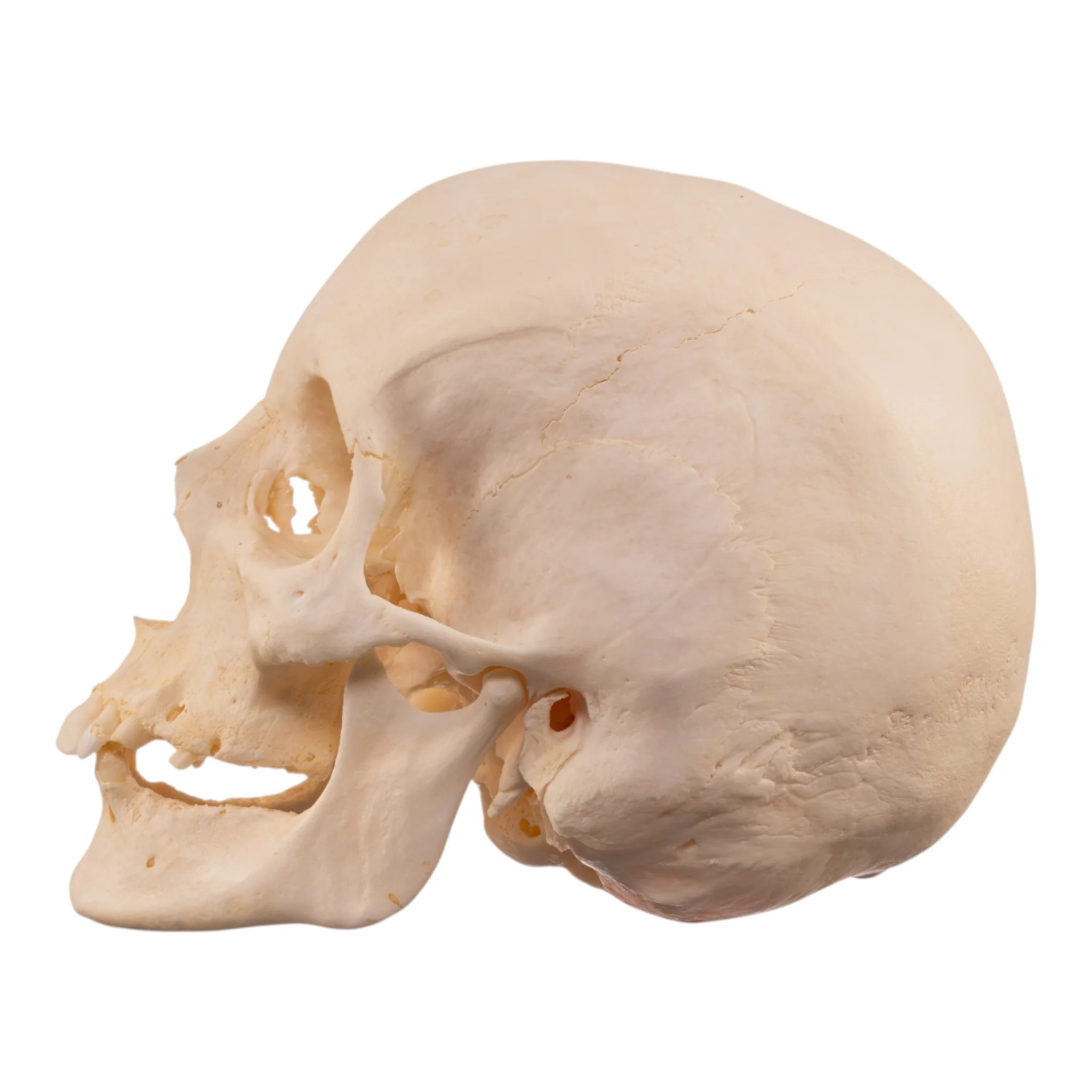 Real Research Quality Human Skull - Pathology - Image 4