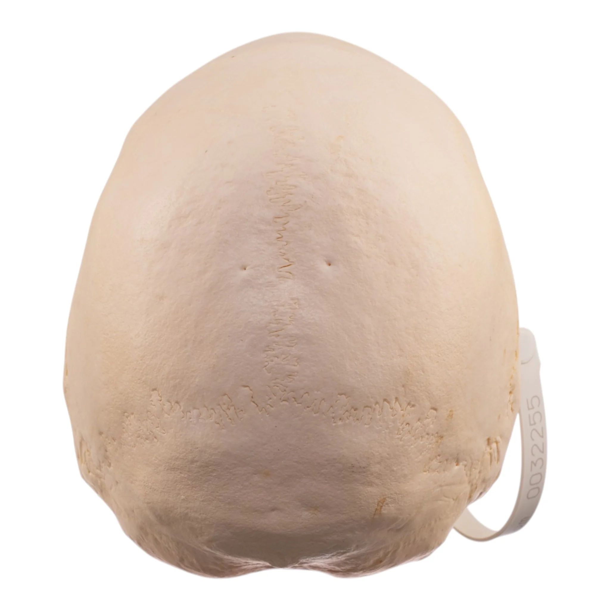 Real Research Quality Human Skull - Pathology - Image 5
