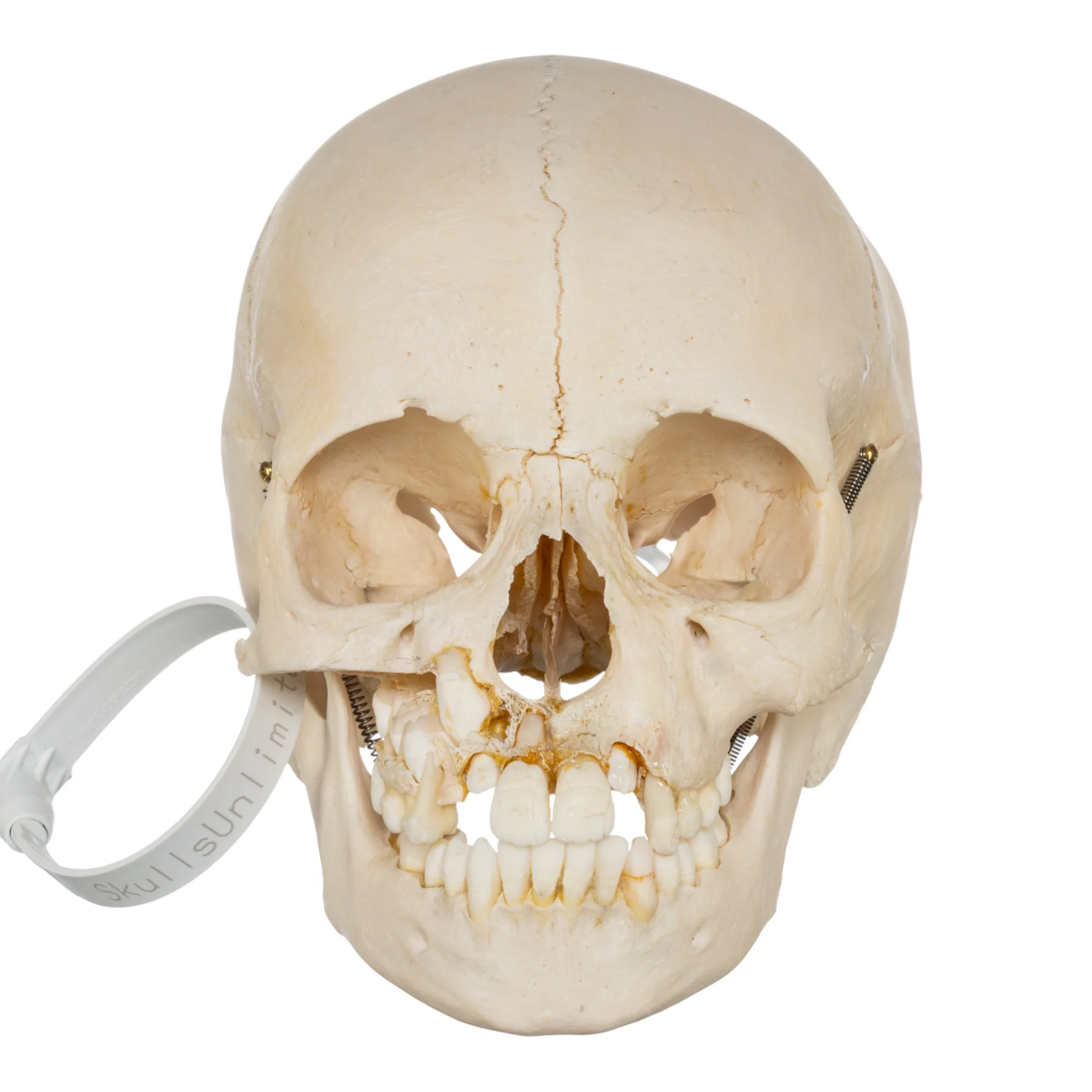 Real Human Child Skull - Damaged - Image 3