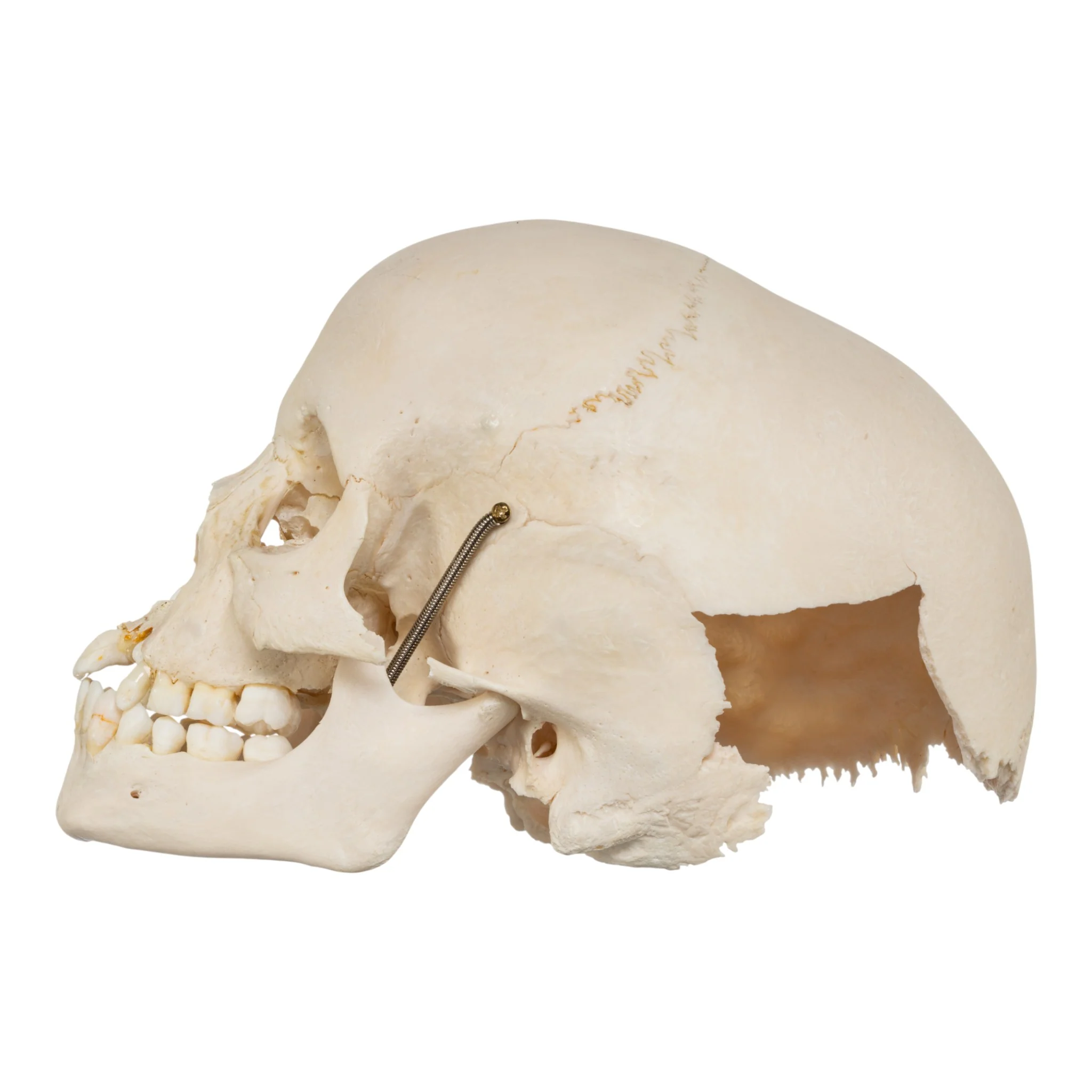 Real Human Child Skull - Damaged - Image 4