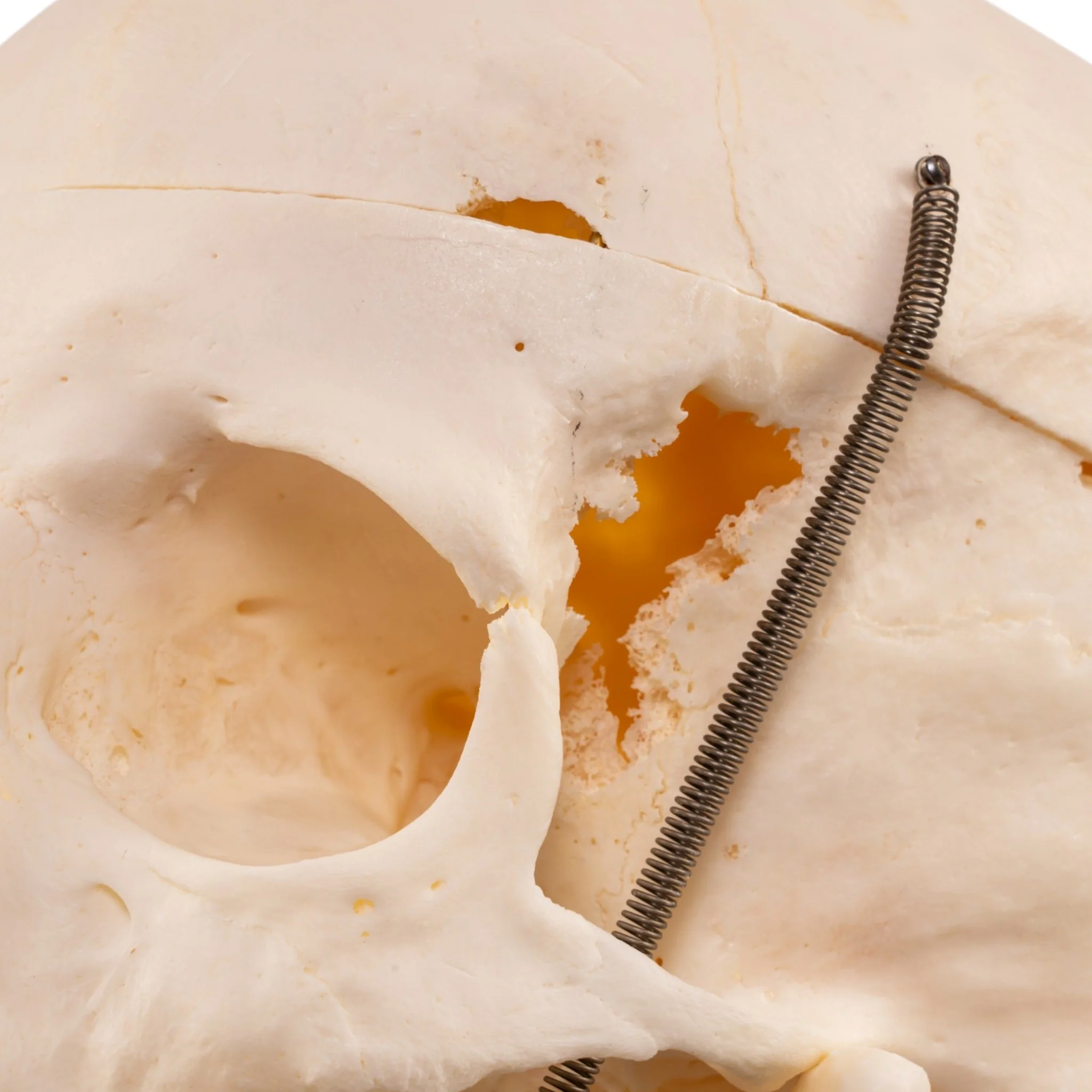 Real Human Skull - Image 12